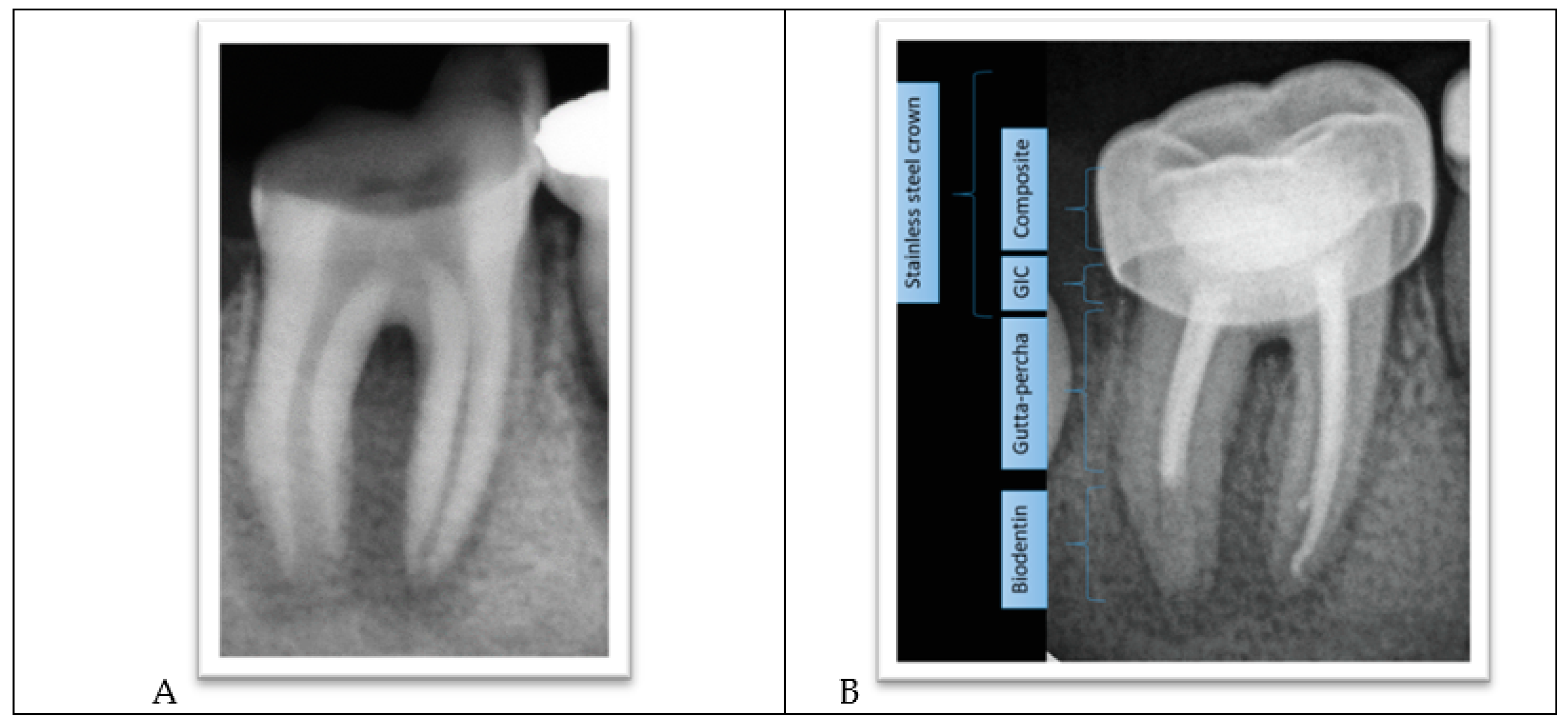 Ijerph 18 01209 g005