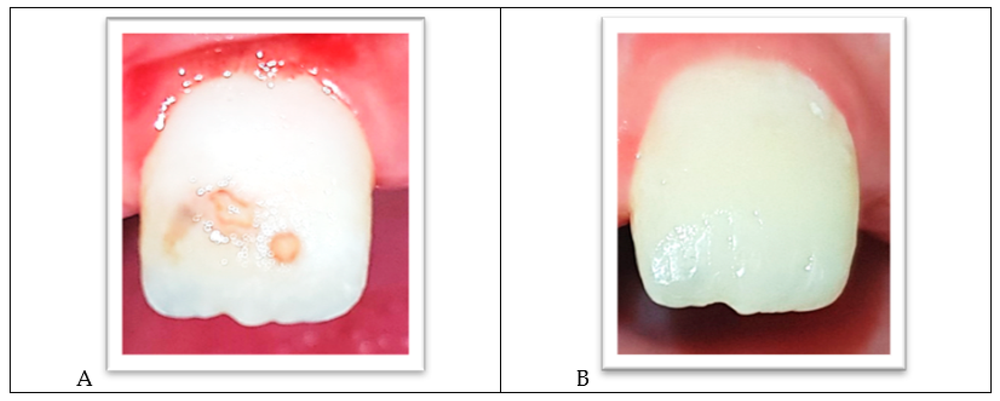 Ijerph 18 01209 g007