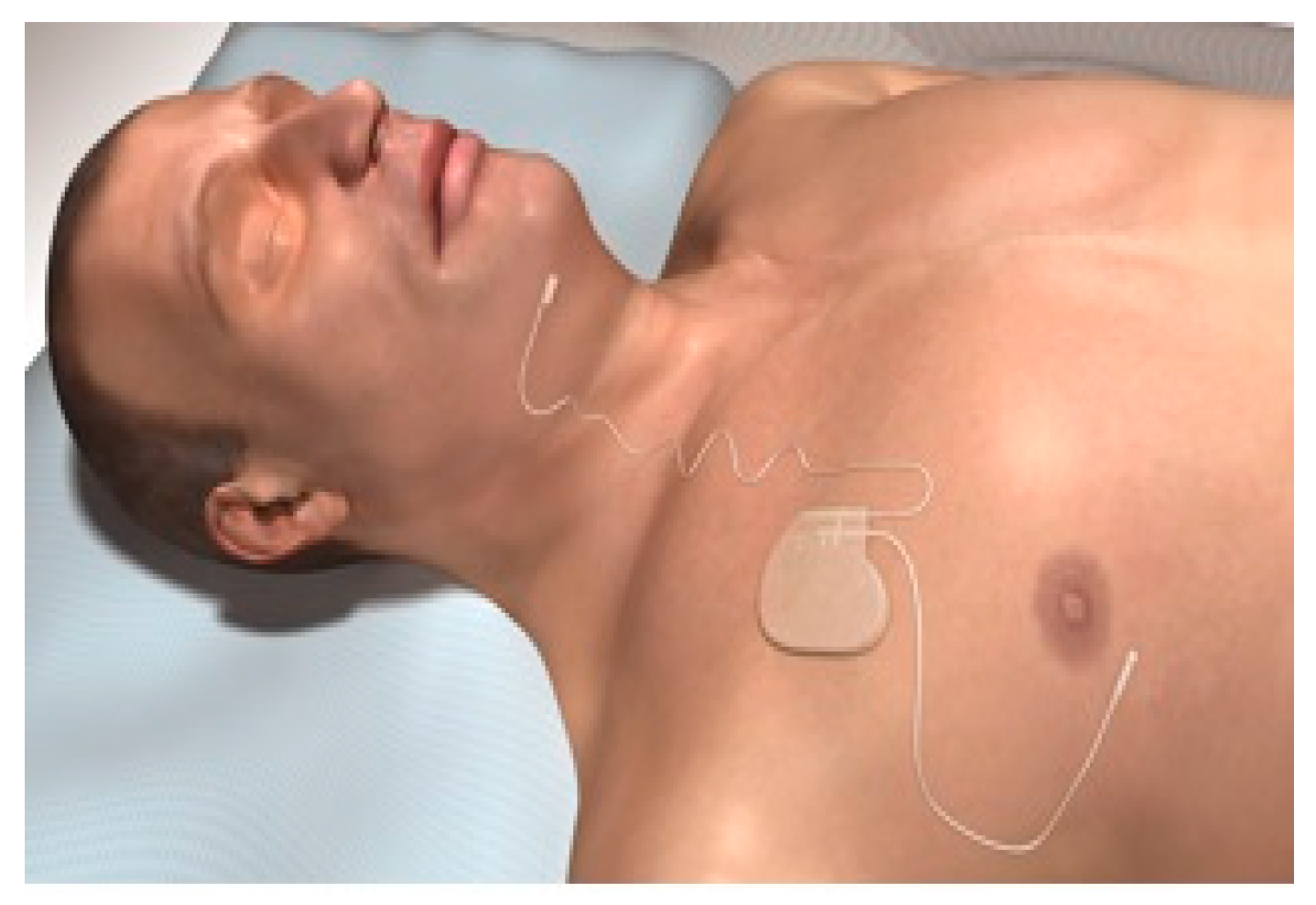 Ijerph 18 01642 g003