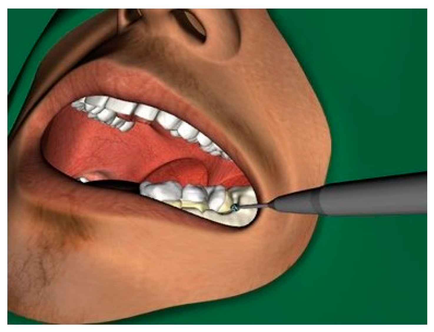 Ijerph 18 01827 g004