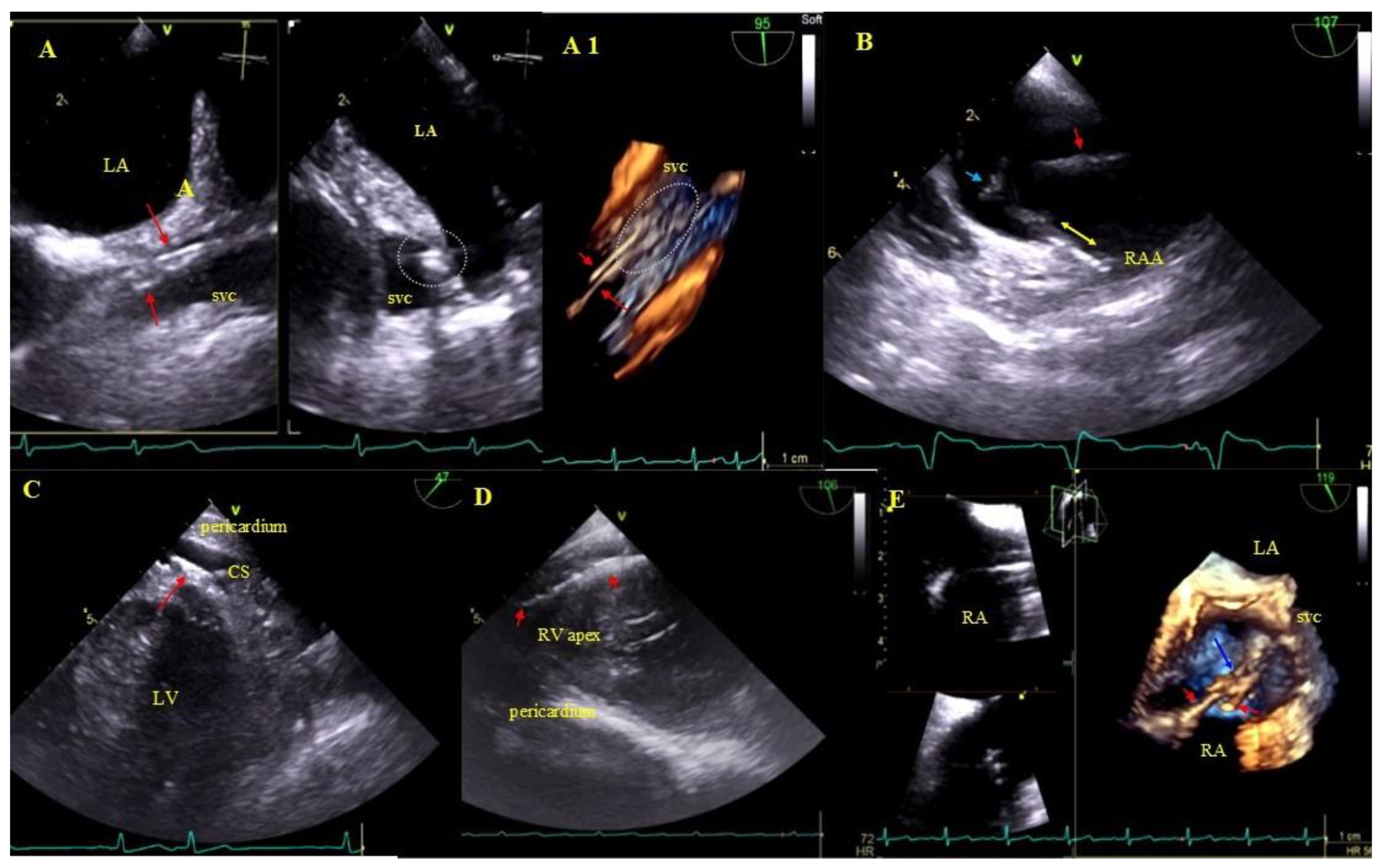 Ijerph 18 01862 g003 Ijerph 18 01862 g003