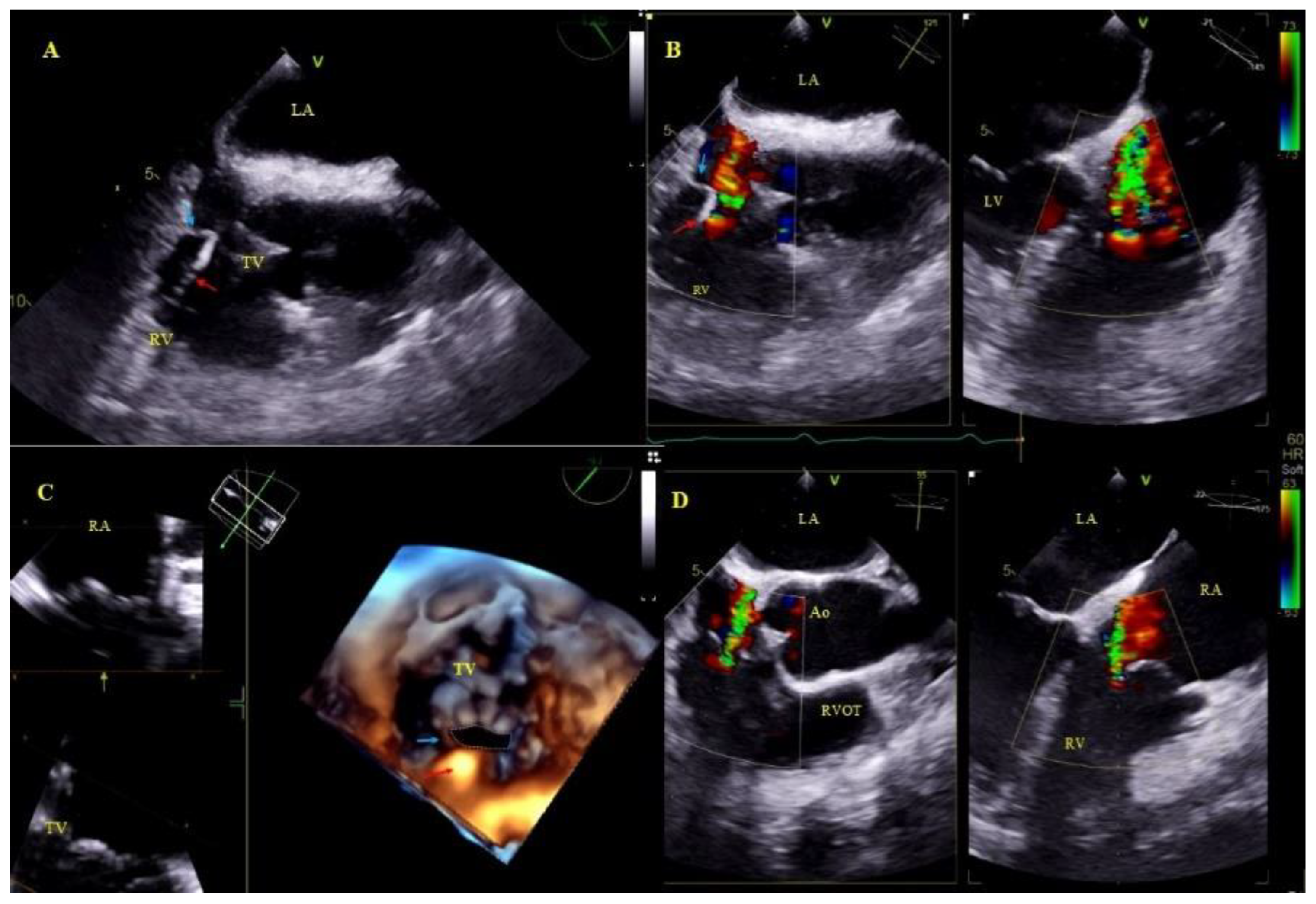 Ijerph 18 01862 g004 Ijerph 18 01862 g004