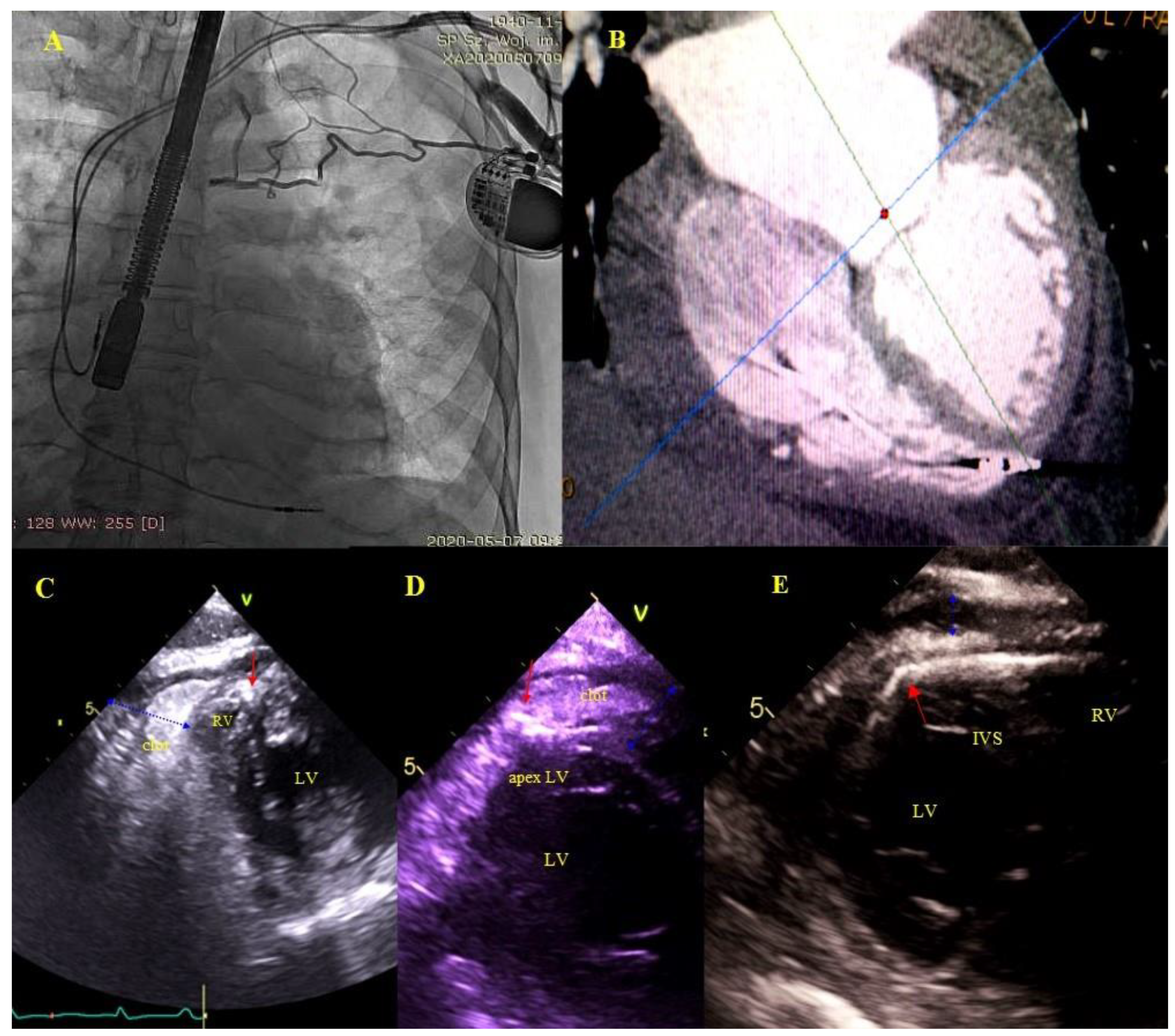 Ijerph 18 01862 g005 Ijerph 18 01862 g005