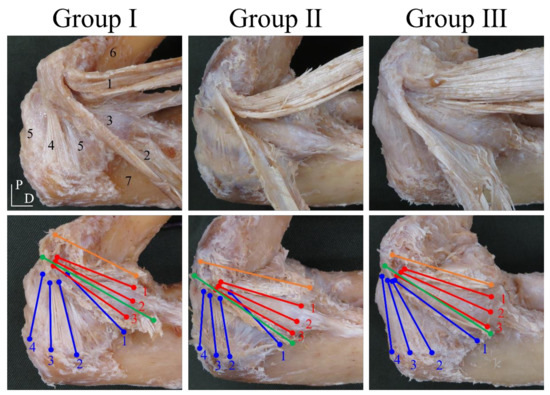 IJERPH | Free Full-Text | The Effects of Differences in the