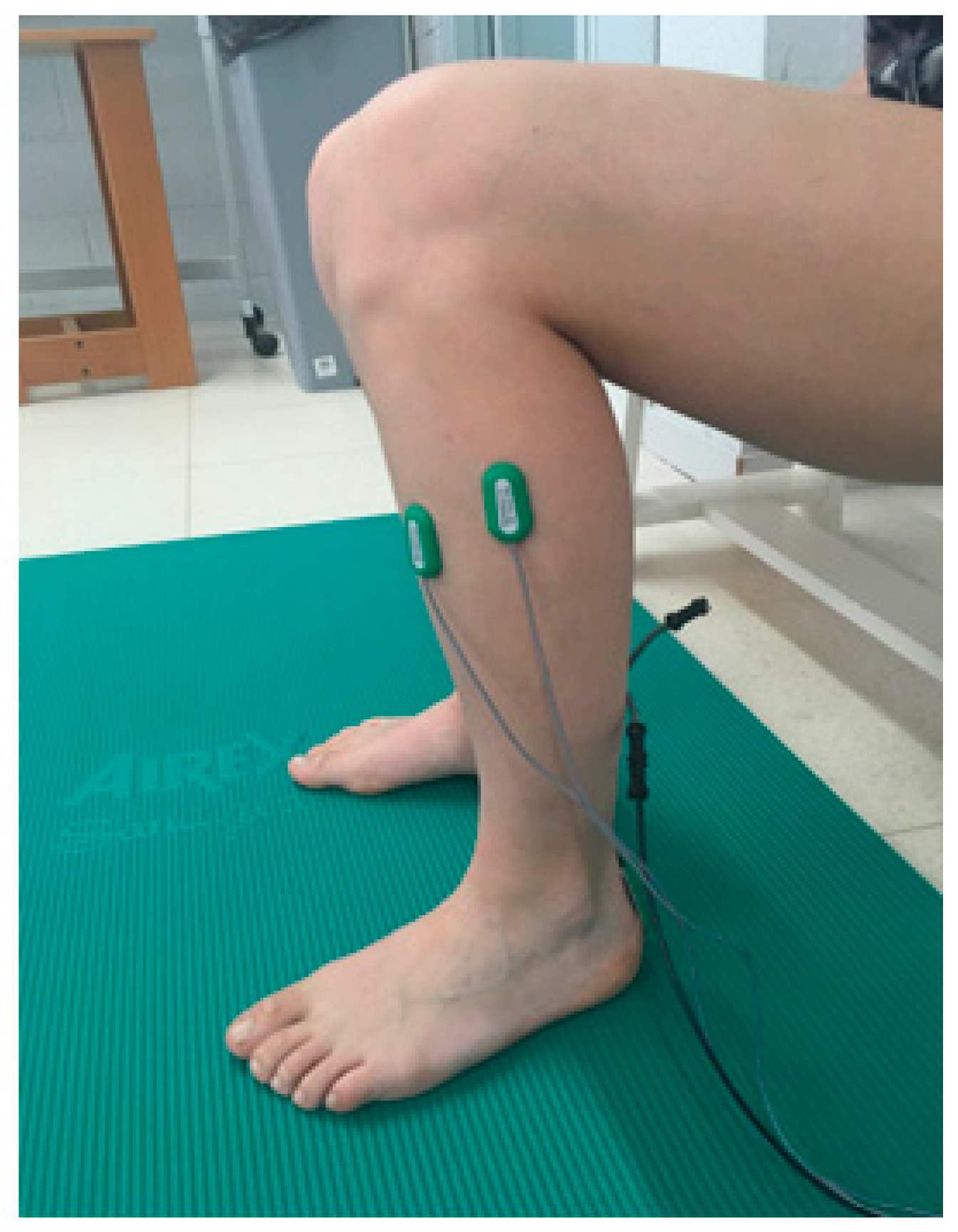 IJERPH Free FullText Effects of Dry Needling on Neuromuscular