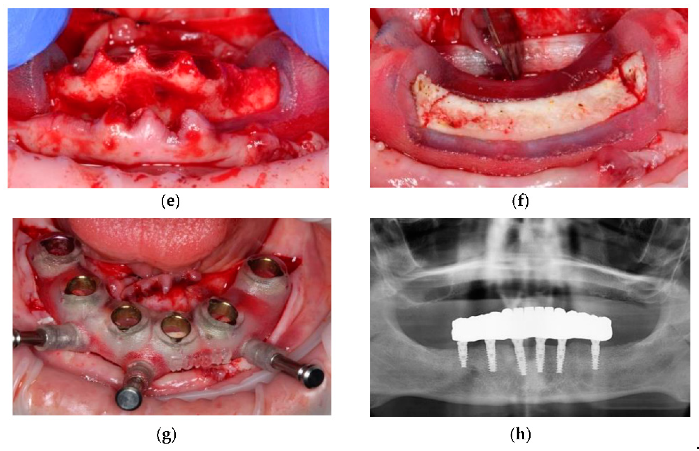 Ijerph 18 02341 g002b