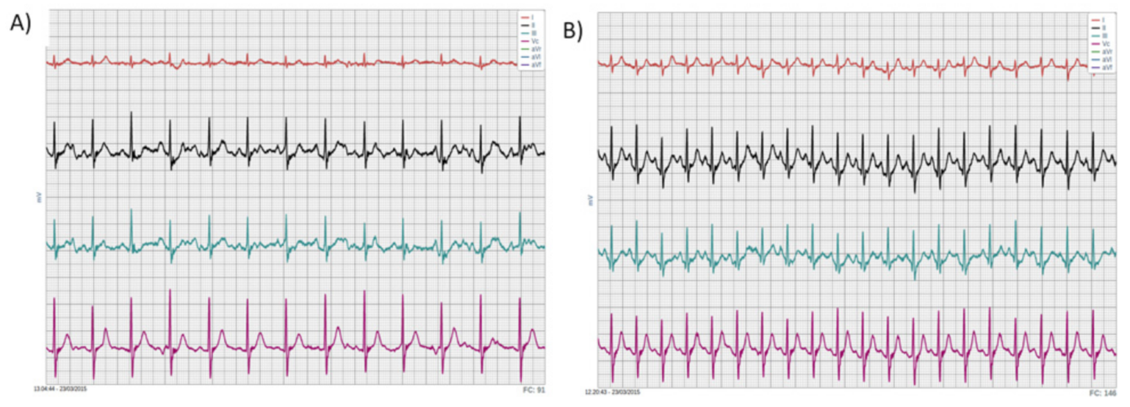 Ijerph 18 02432 g003