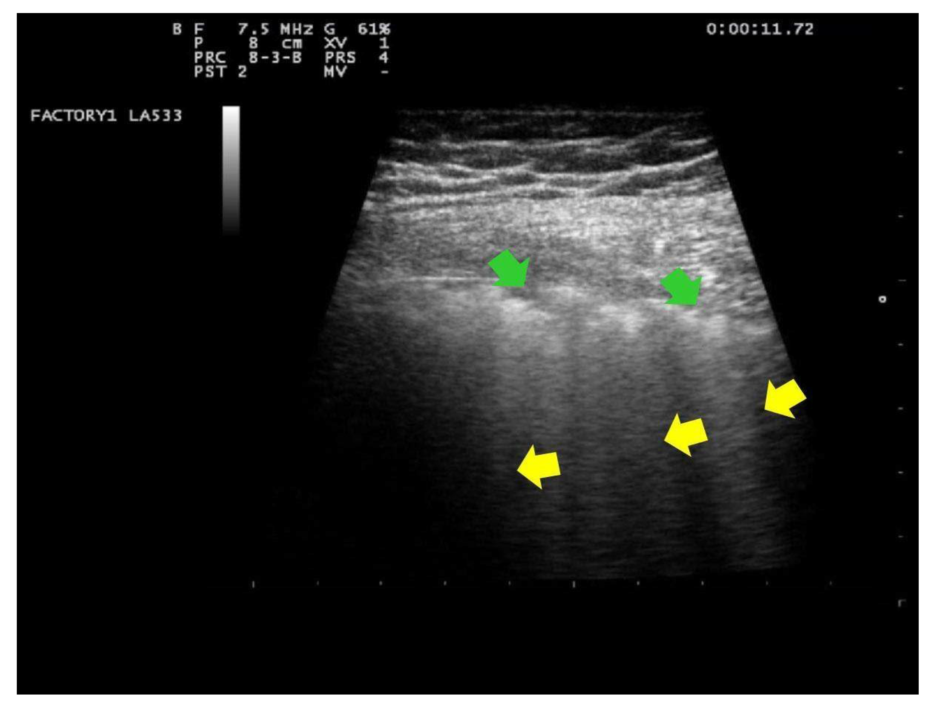 Ijerph 18 02762 g003