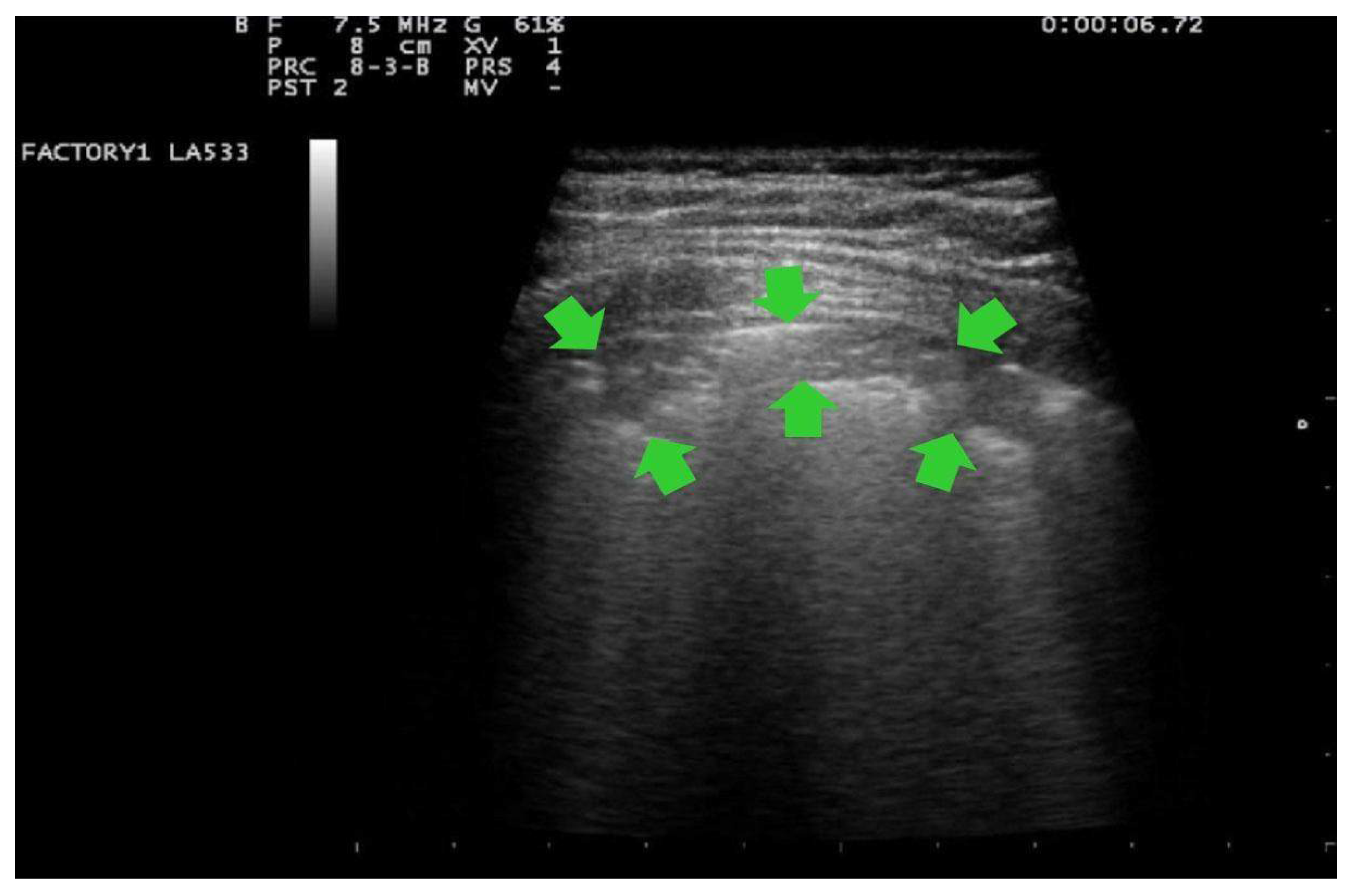 Ijerph 18 02762 g004