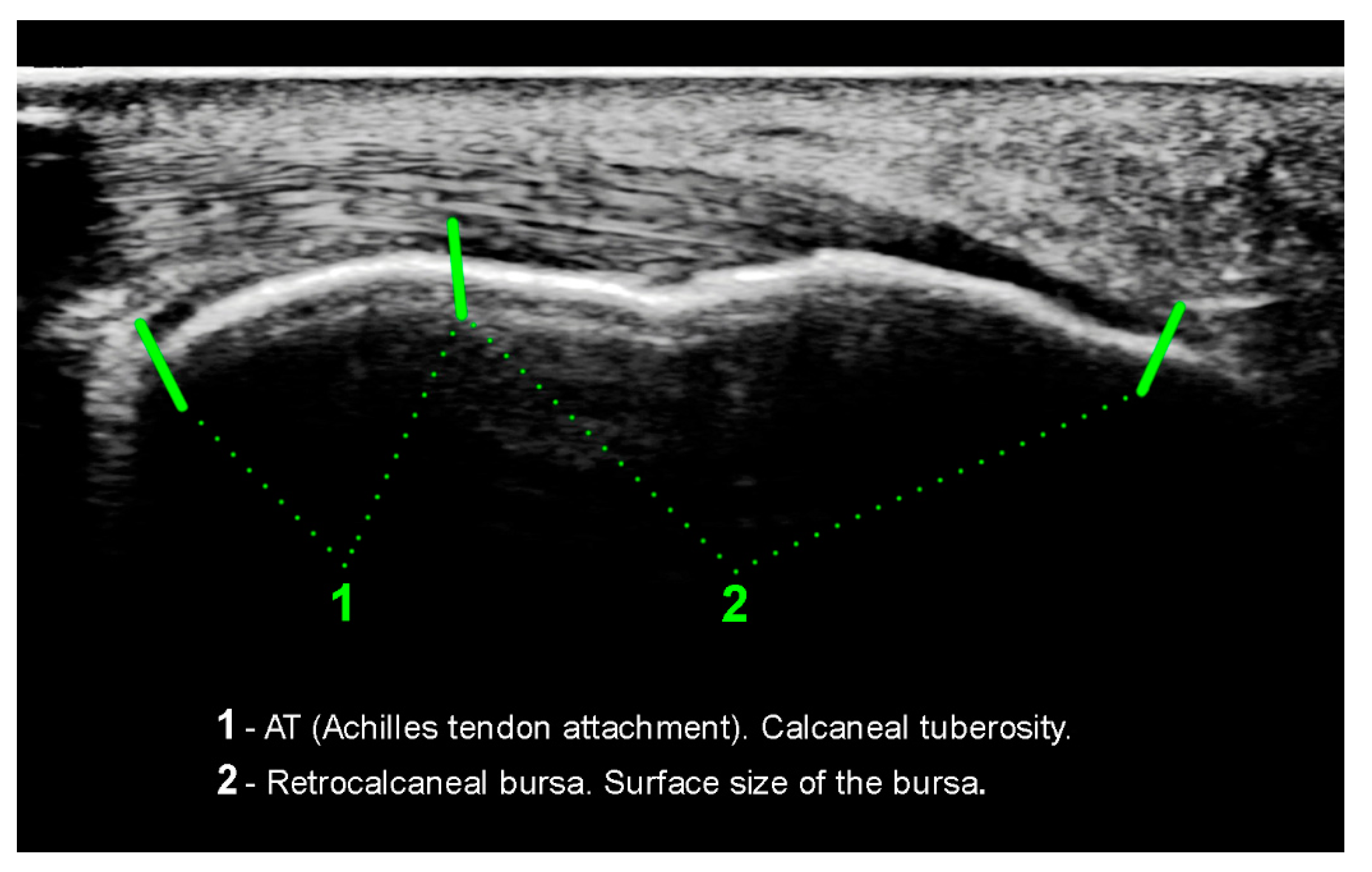 Ijerph 18 02860 g004