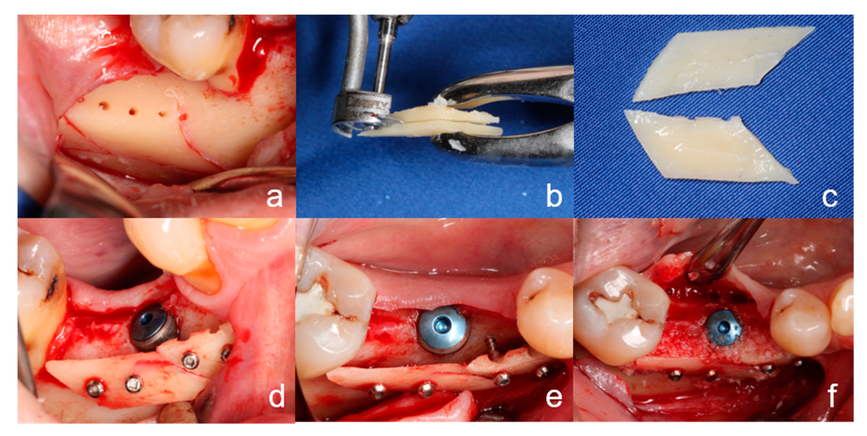 Ijerph 18 03174 g001