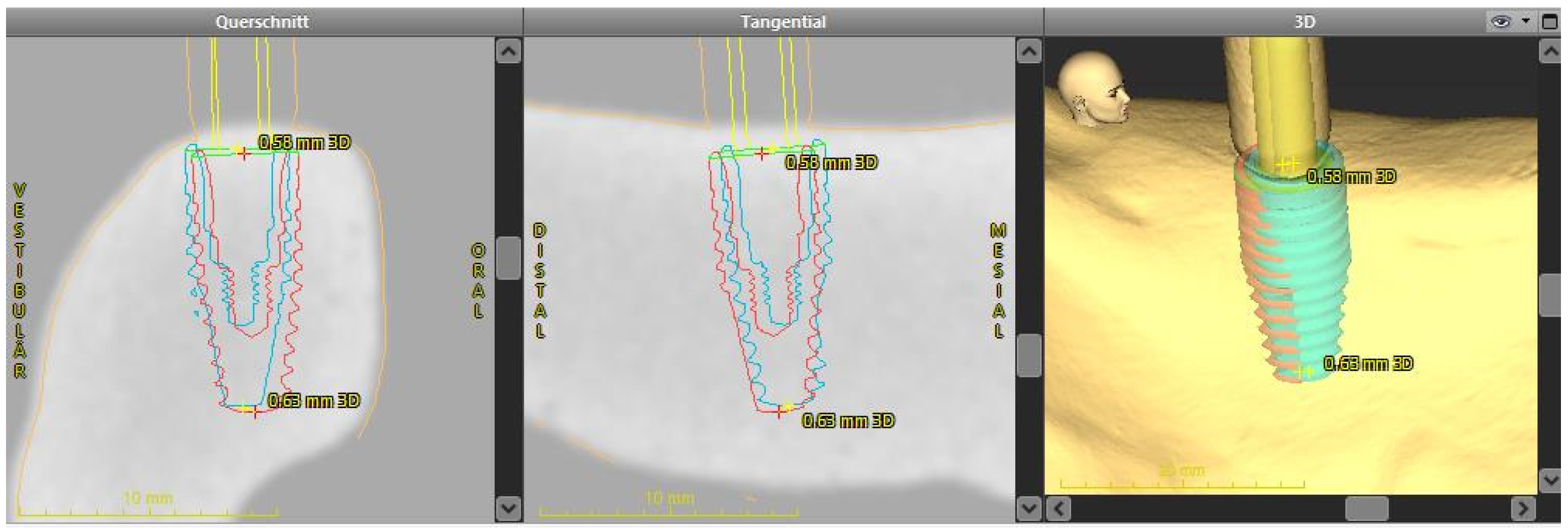 Ijerph 18 03244 g005