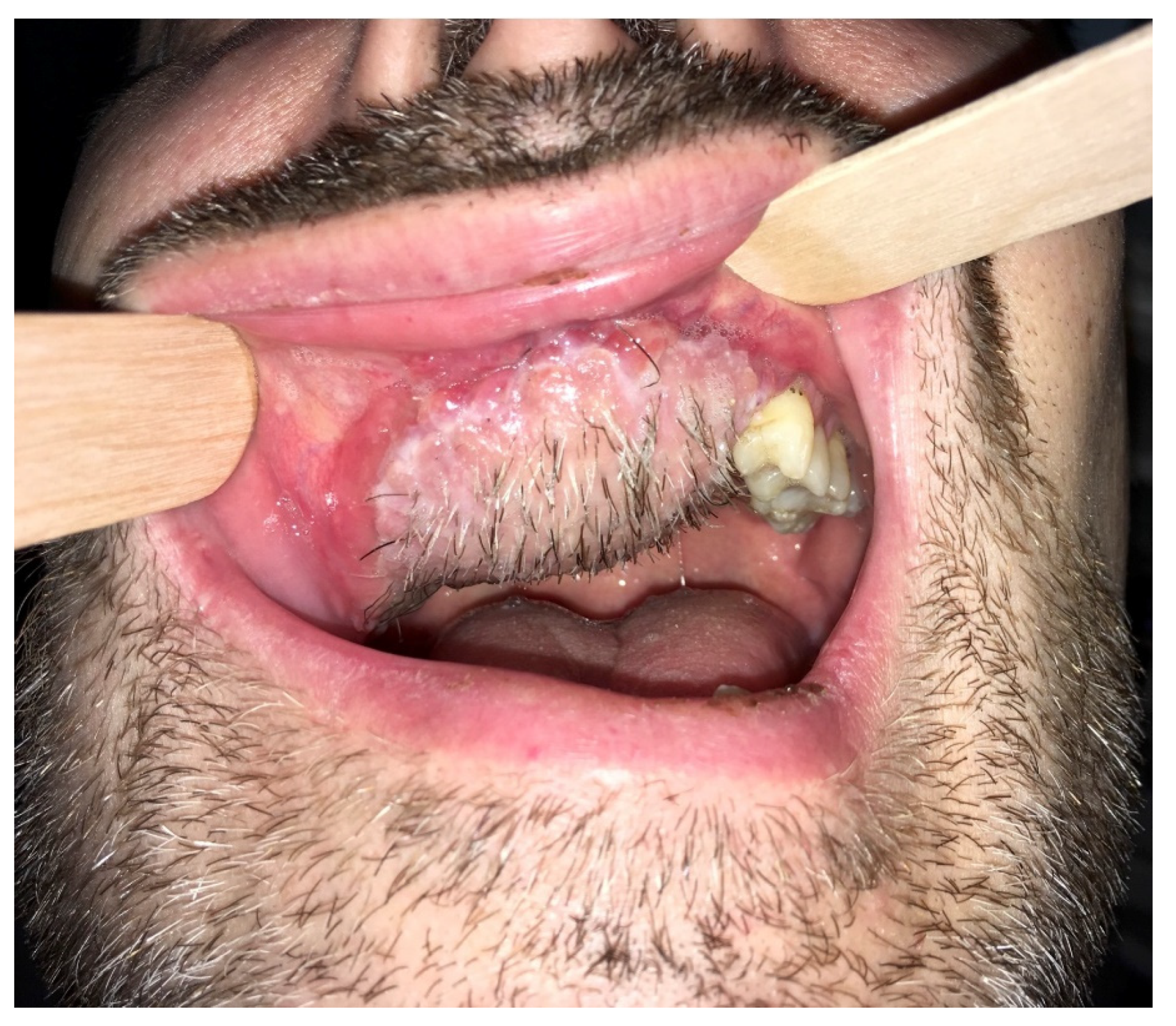 Ijerph 18 03341 g006