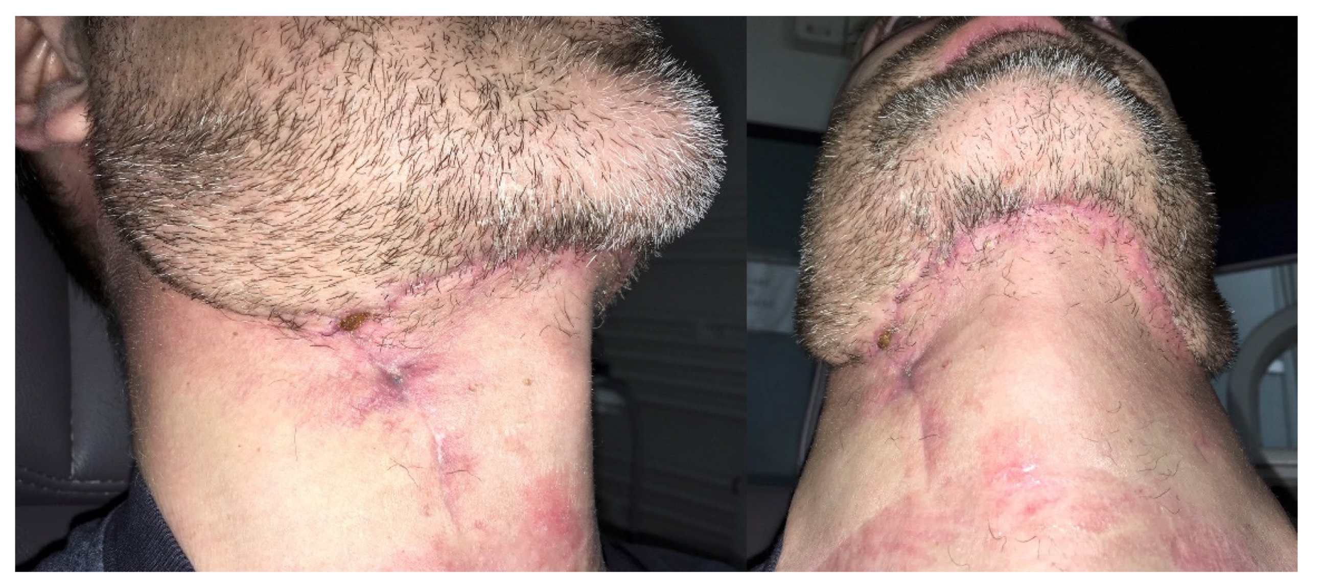 Ijerph 18 03341 g007