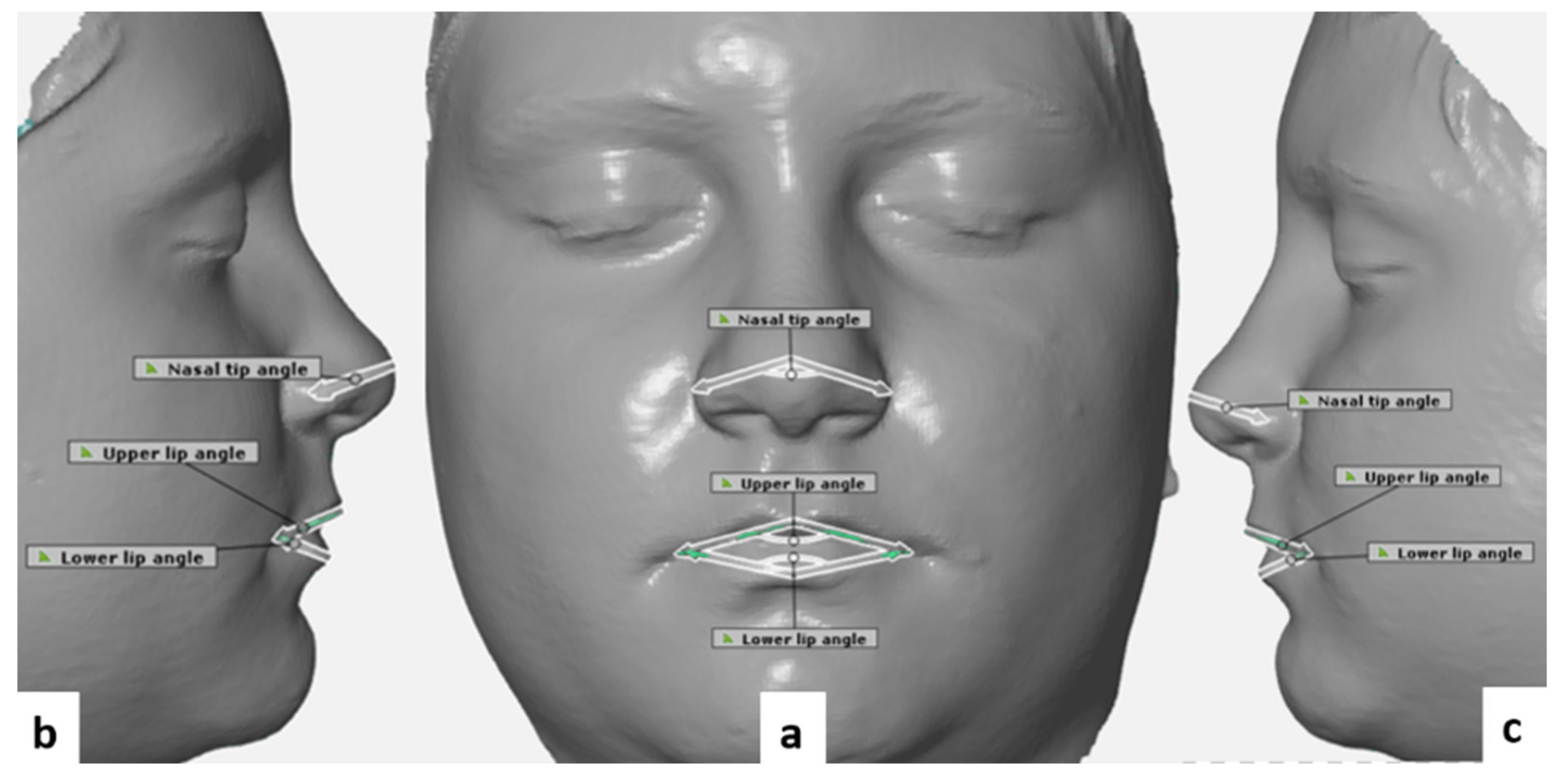 Ijerph 18 03379 g004