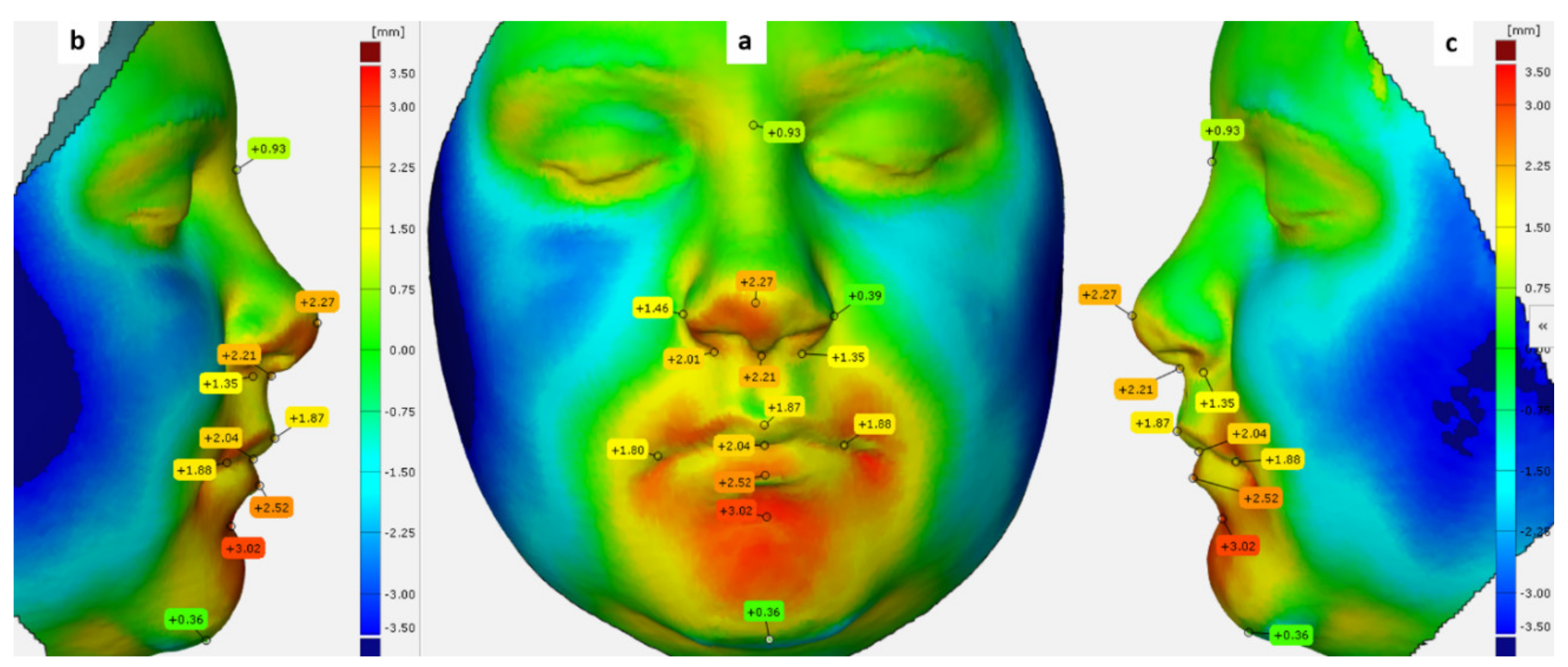 Ijerph 18 03379 g007