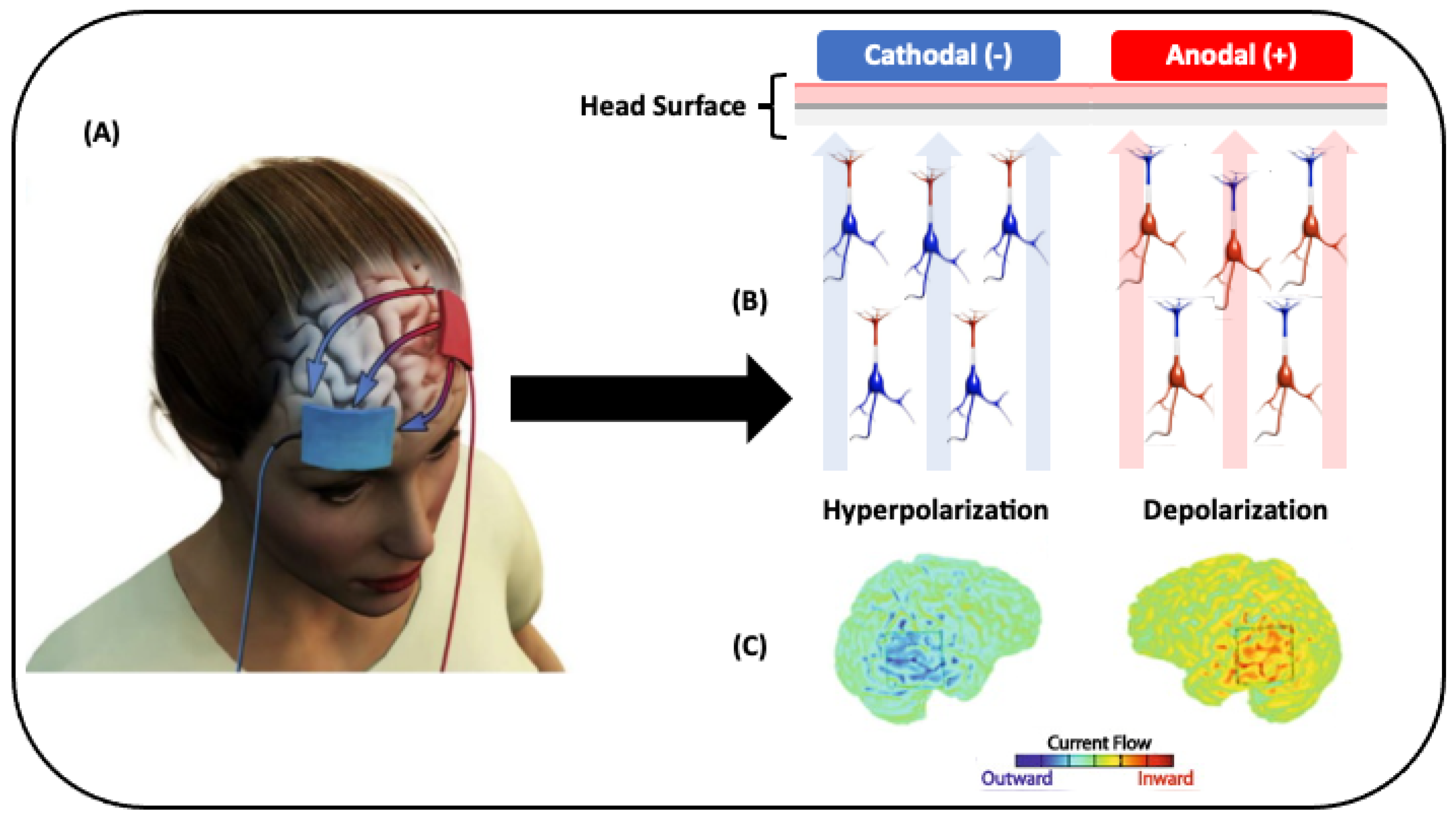 Transcranial direct current stimulation