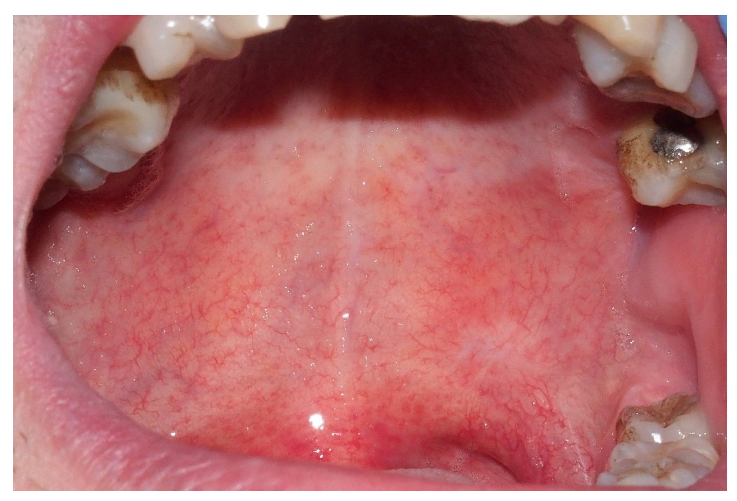 Ijerph 18 03762 g005 Ijerph 18 03762 g005