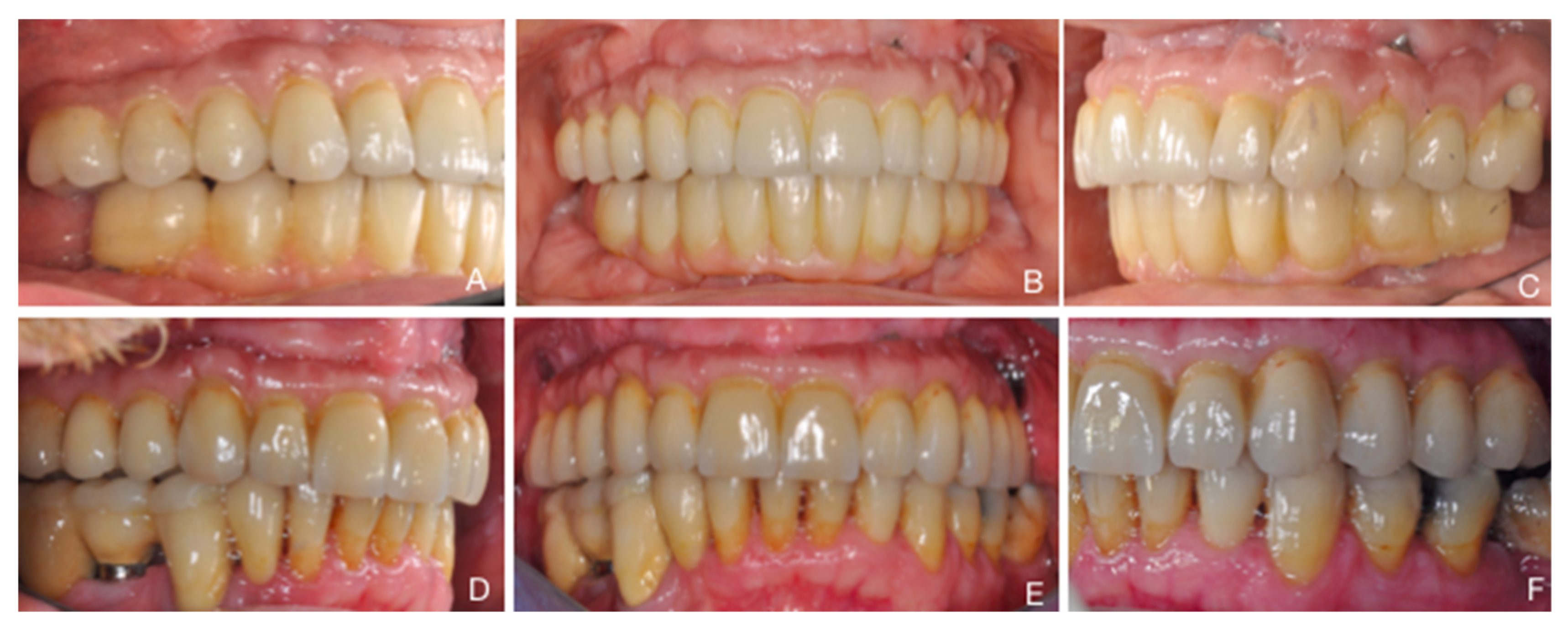 Ijerph 18 03846 g002 Ijerph 18 03846 g002