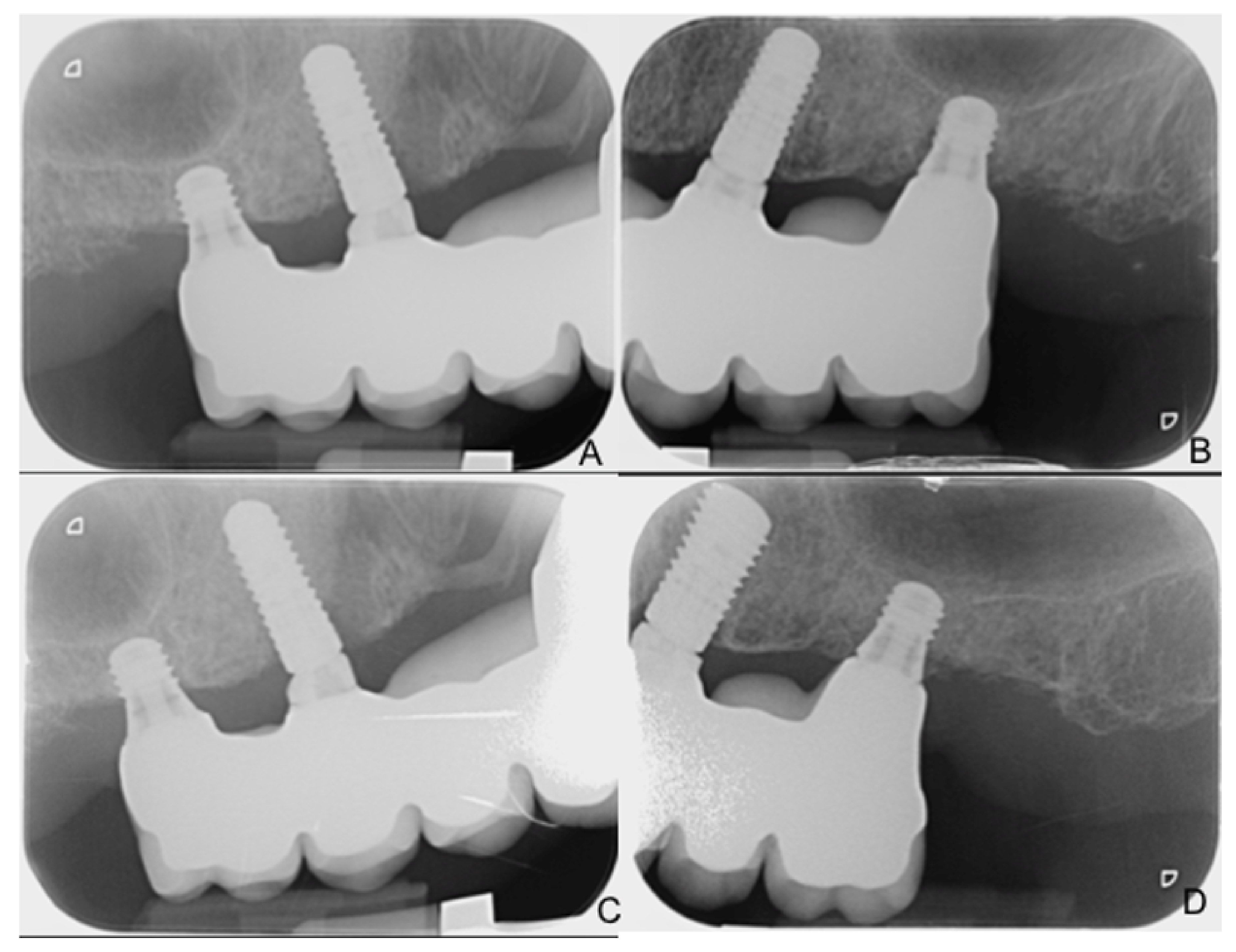 Ijerph 18 03846 g004 Ijerph 18 03846 g004