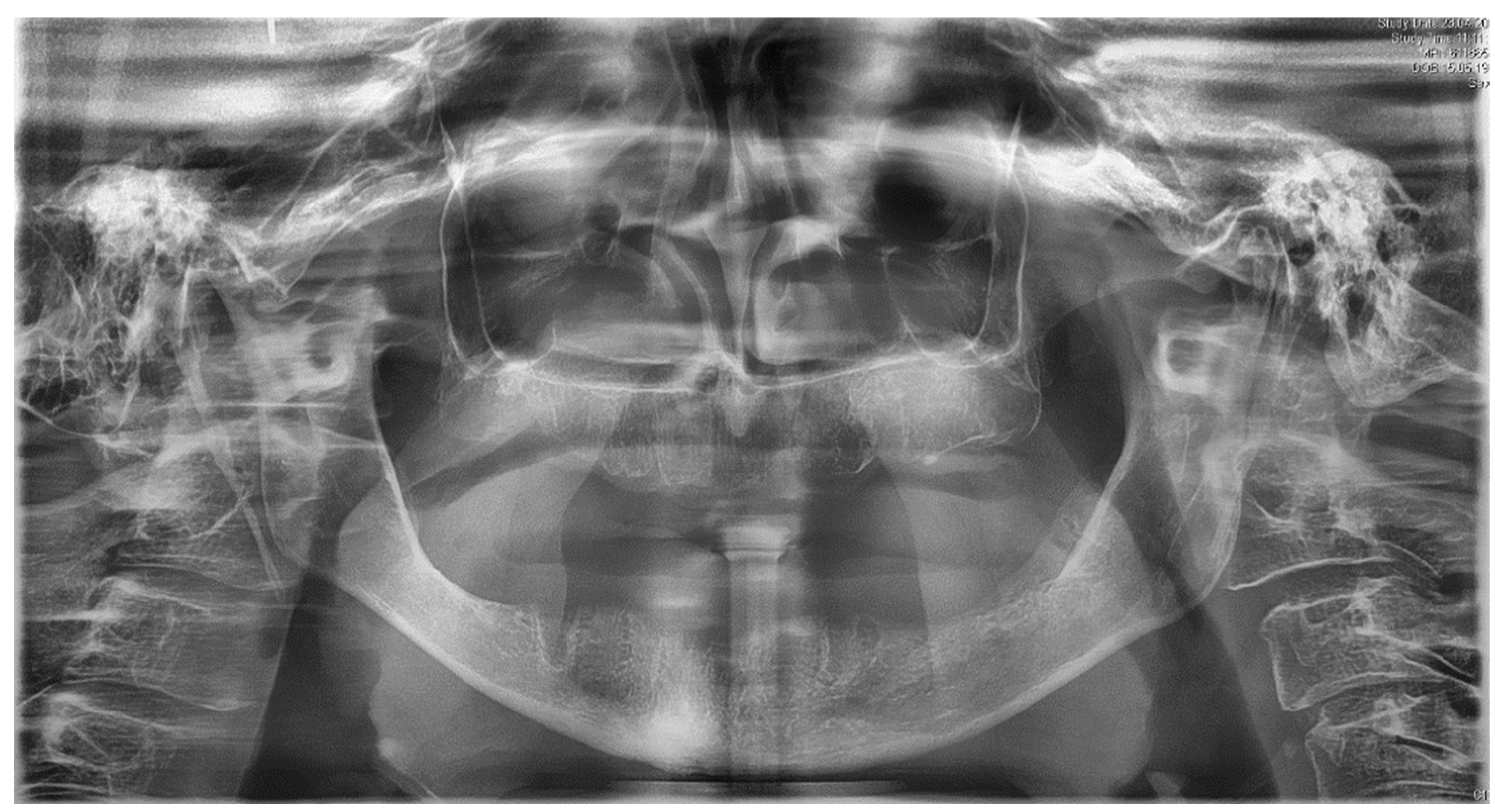 Ijerph 18 04169 g003 Ijerph 18 04169 g003