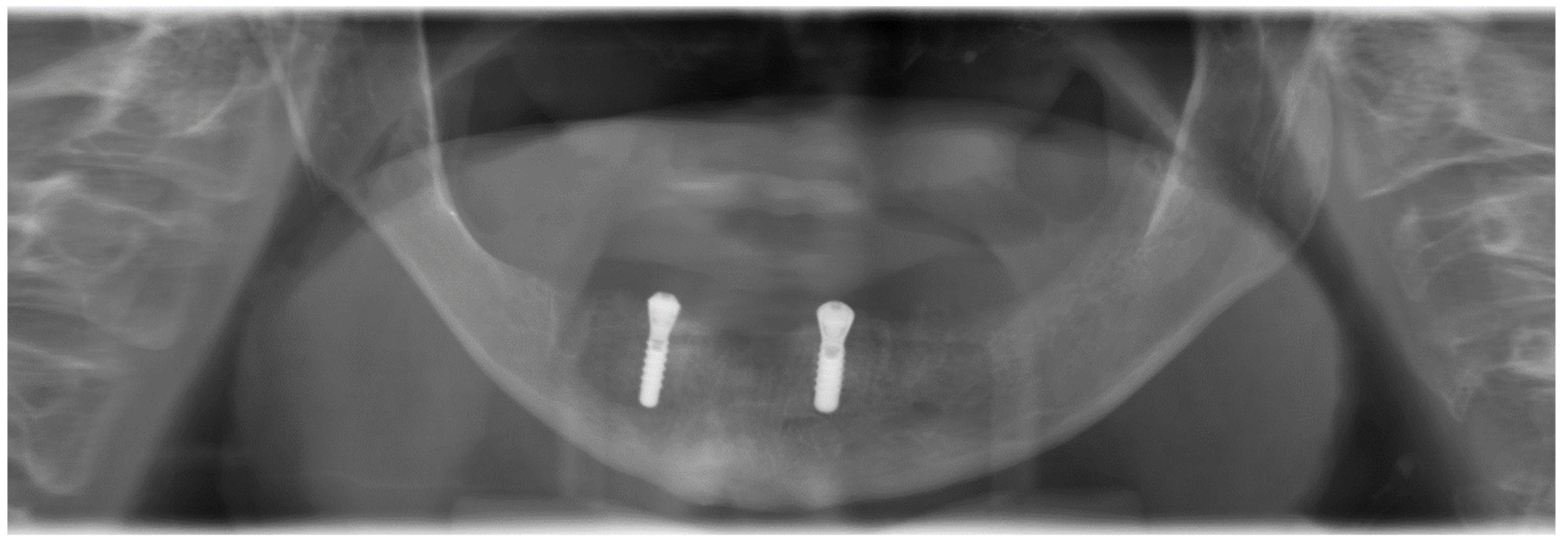 Ijerph 18 04169 g004 Ijerph 18 04169 g004