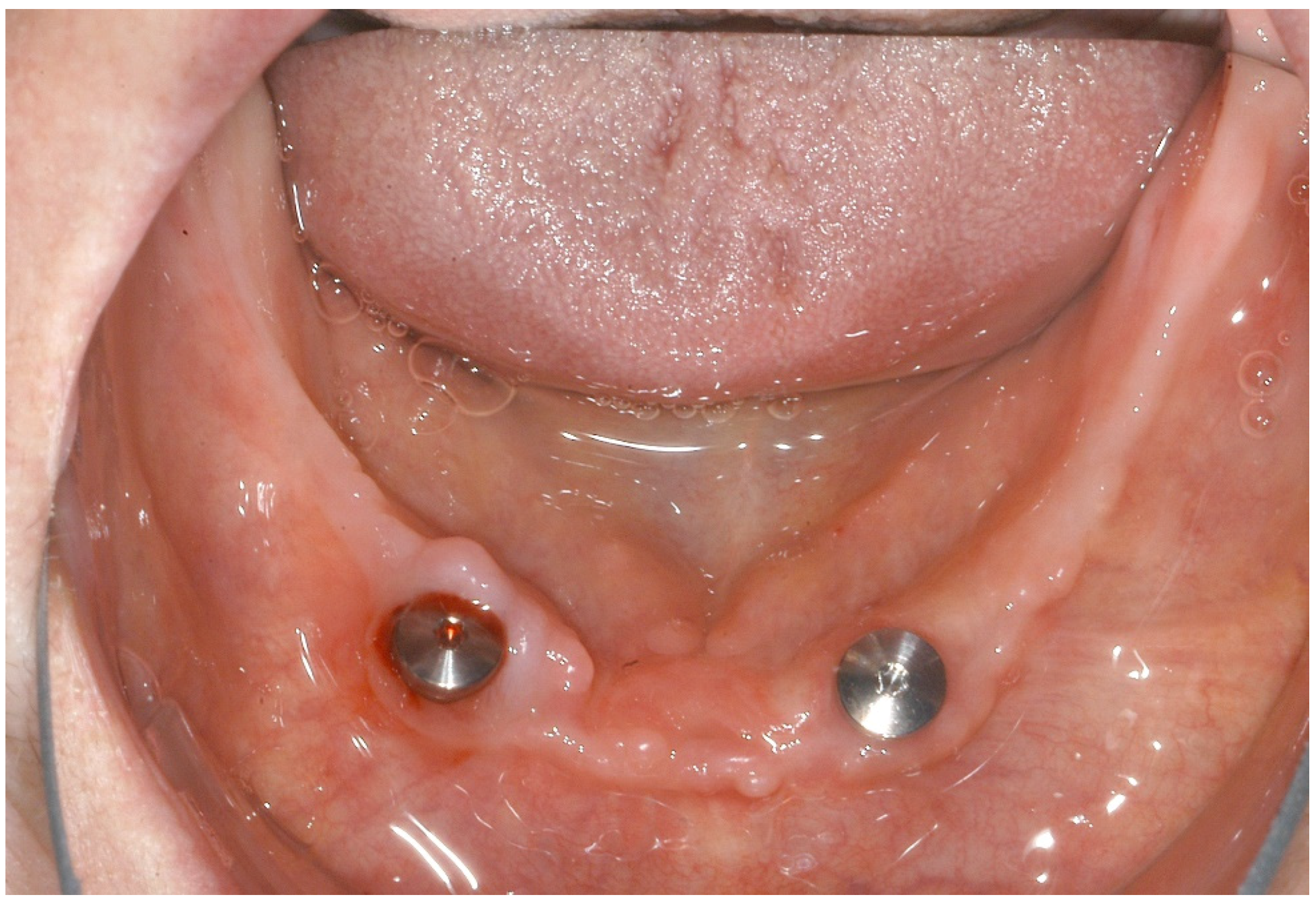 Ijerph 18 04169 g005 Ijerph 18 04169 g005