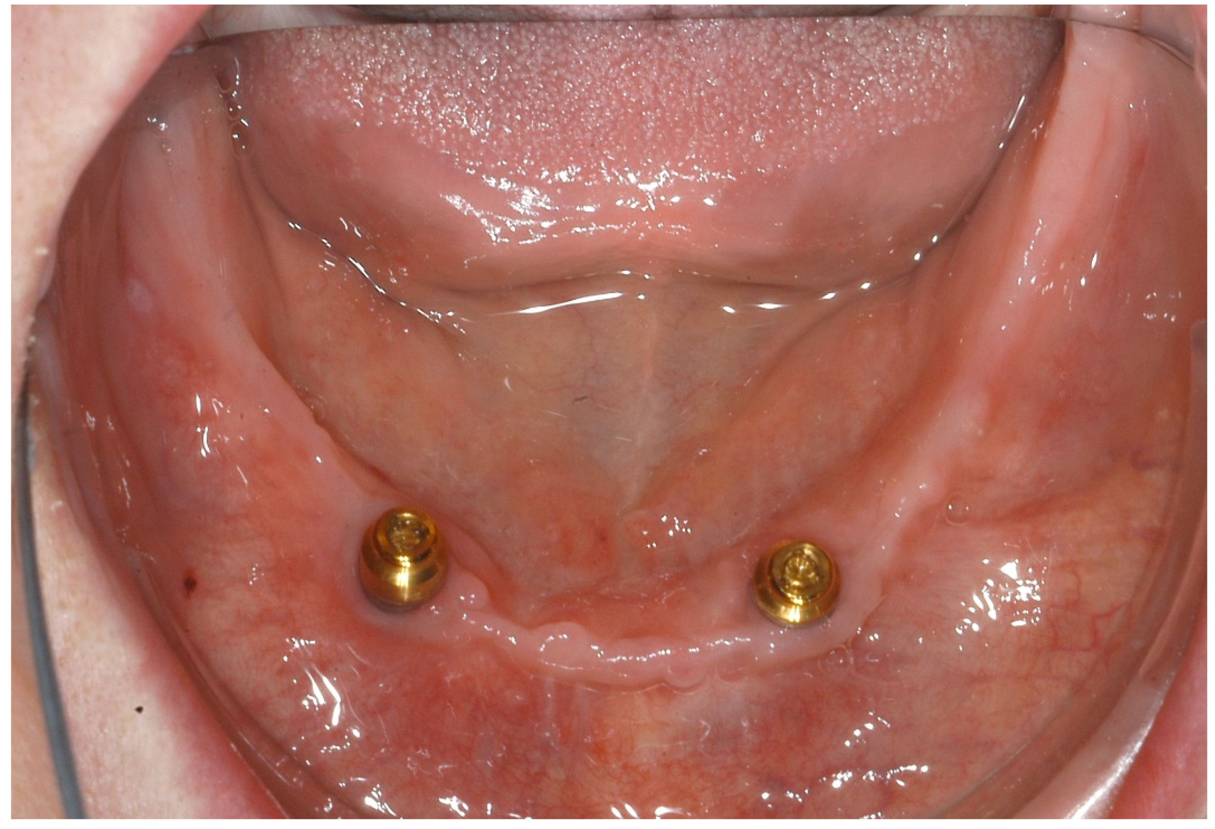 Ijerph 18 04169 g006 Ijerph 18 04169 g006