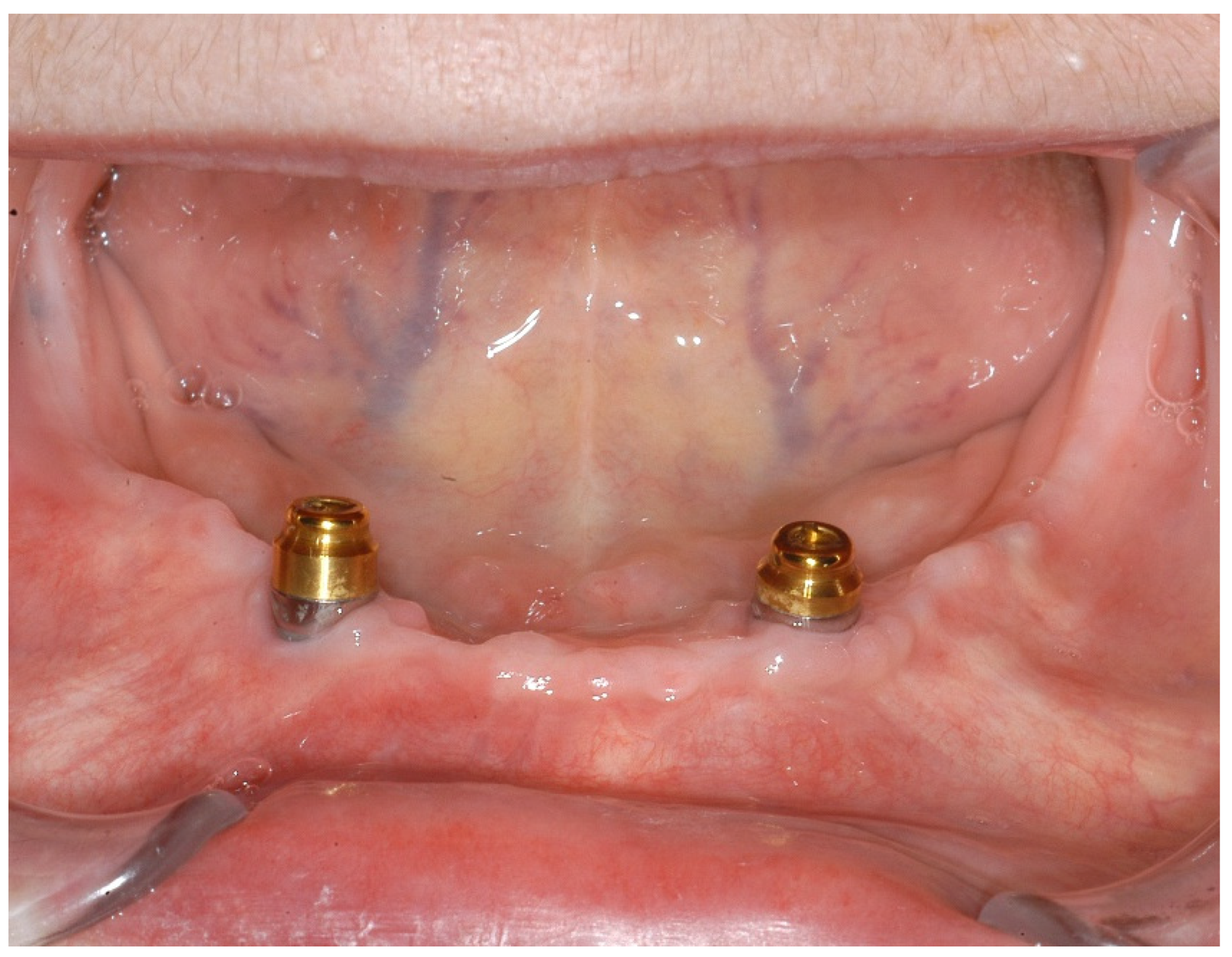 Ijerph 18 04169 g008 Ijerph 18 04169 g008