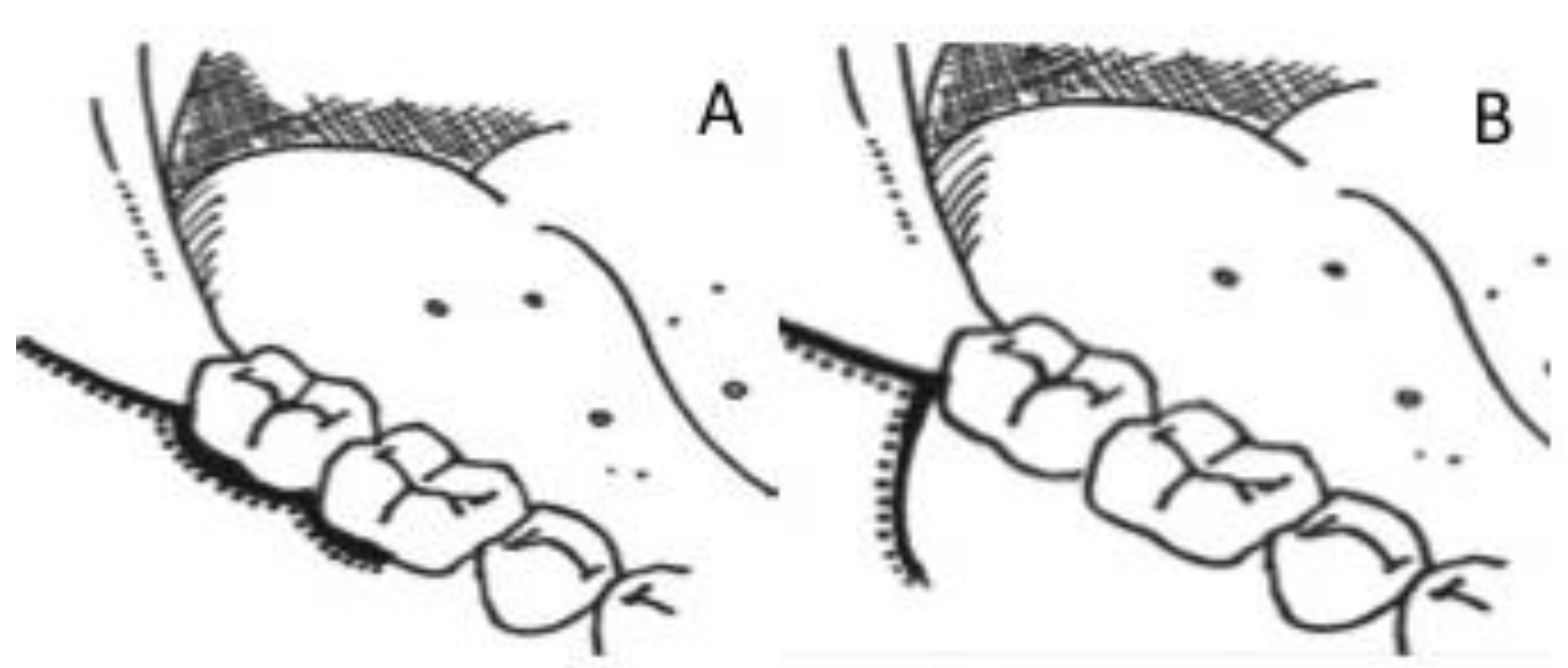 Ijerph 18 04465 g001 Ijerph 18 04465 g001