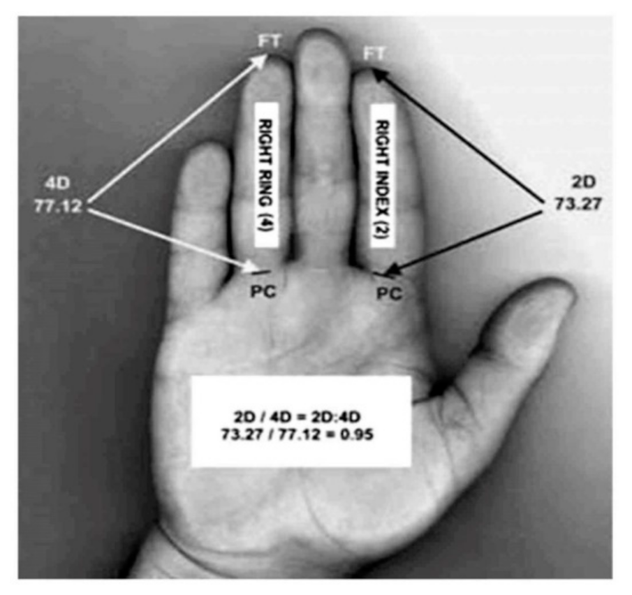 Ijerph 18 04494 g001