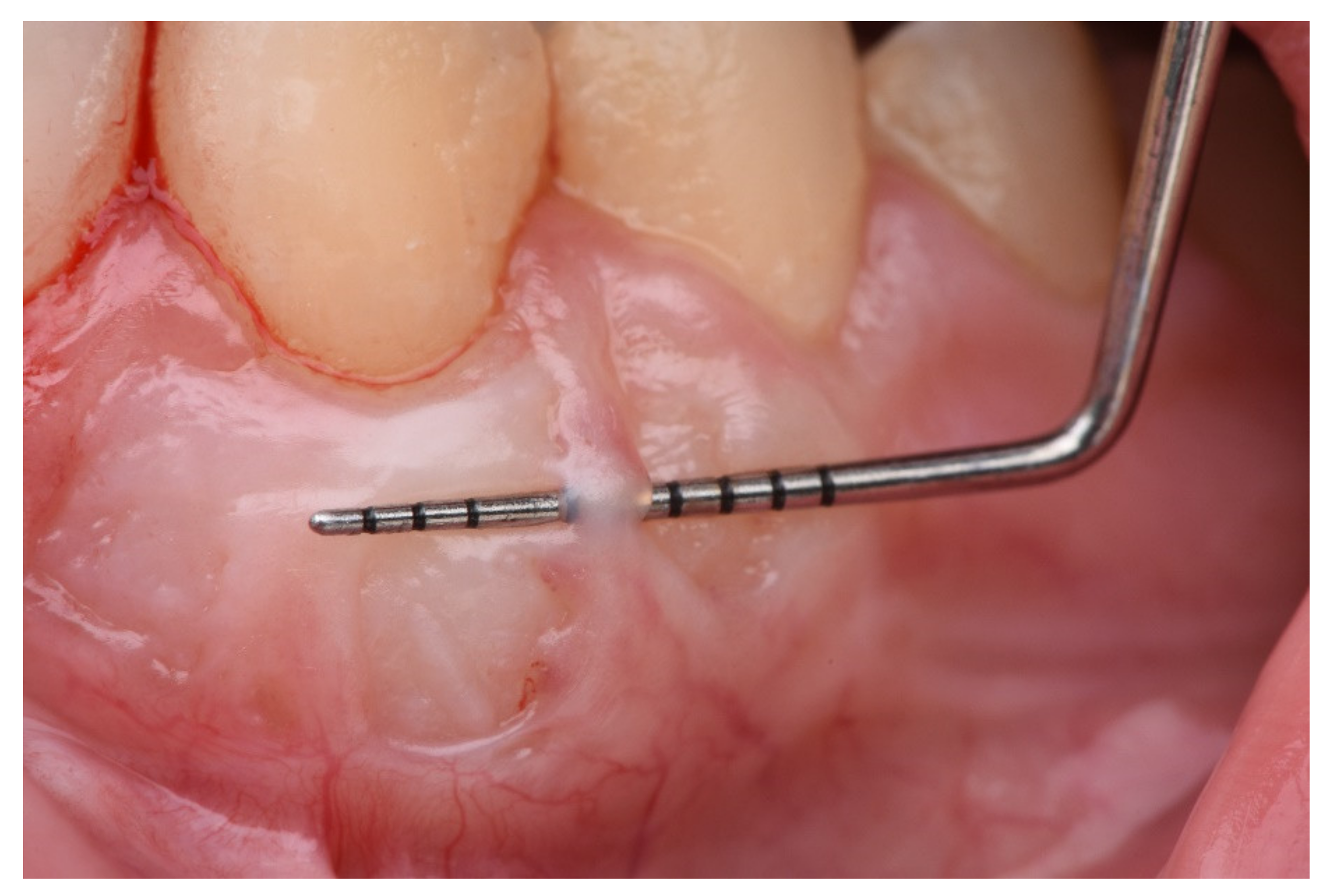 Ijerph 18 04504 g004