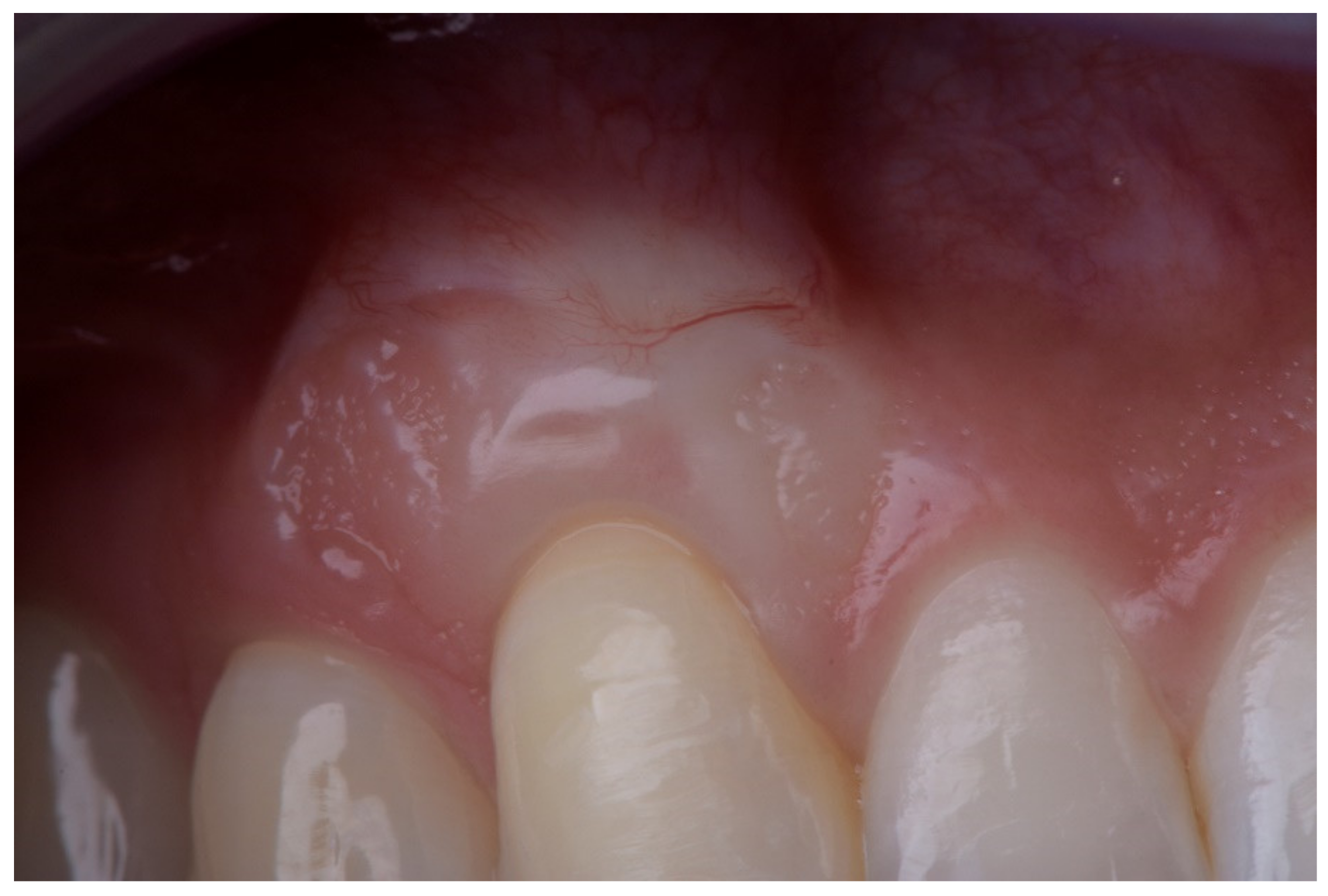 Ijerph 18 04504 g005