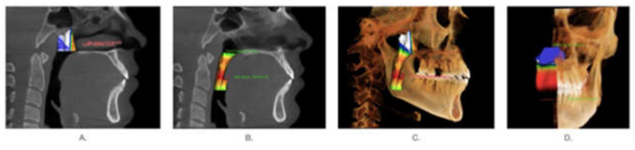 Ijerph 18 05040 g001