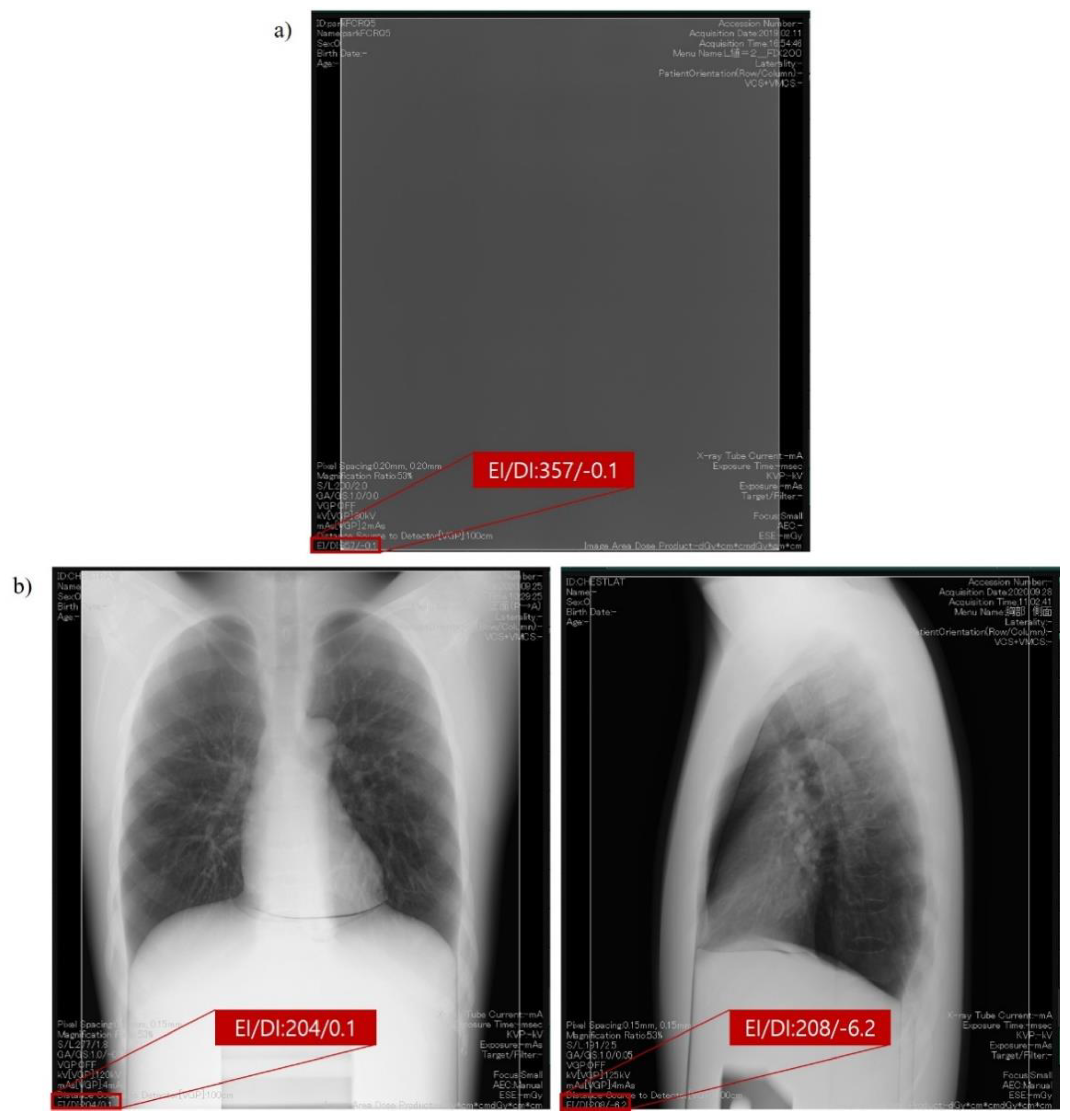 exposure to x ray