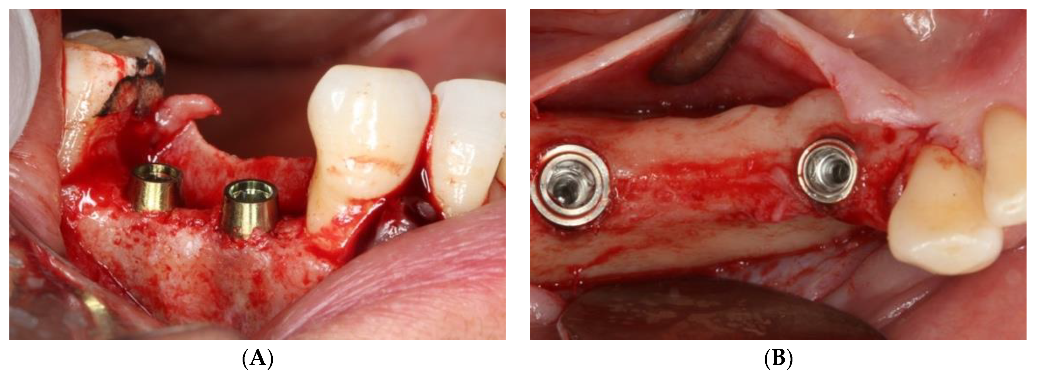 Ijerph 18 05232 g001