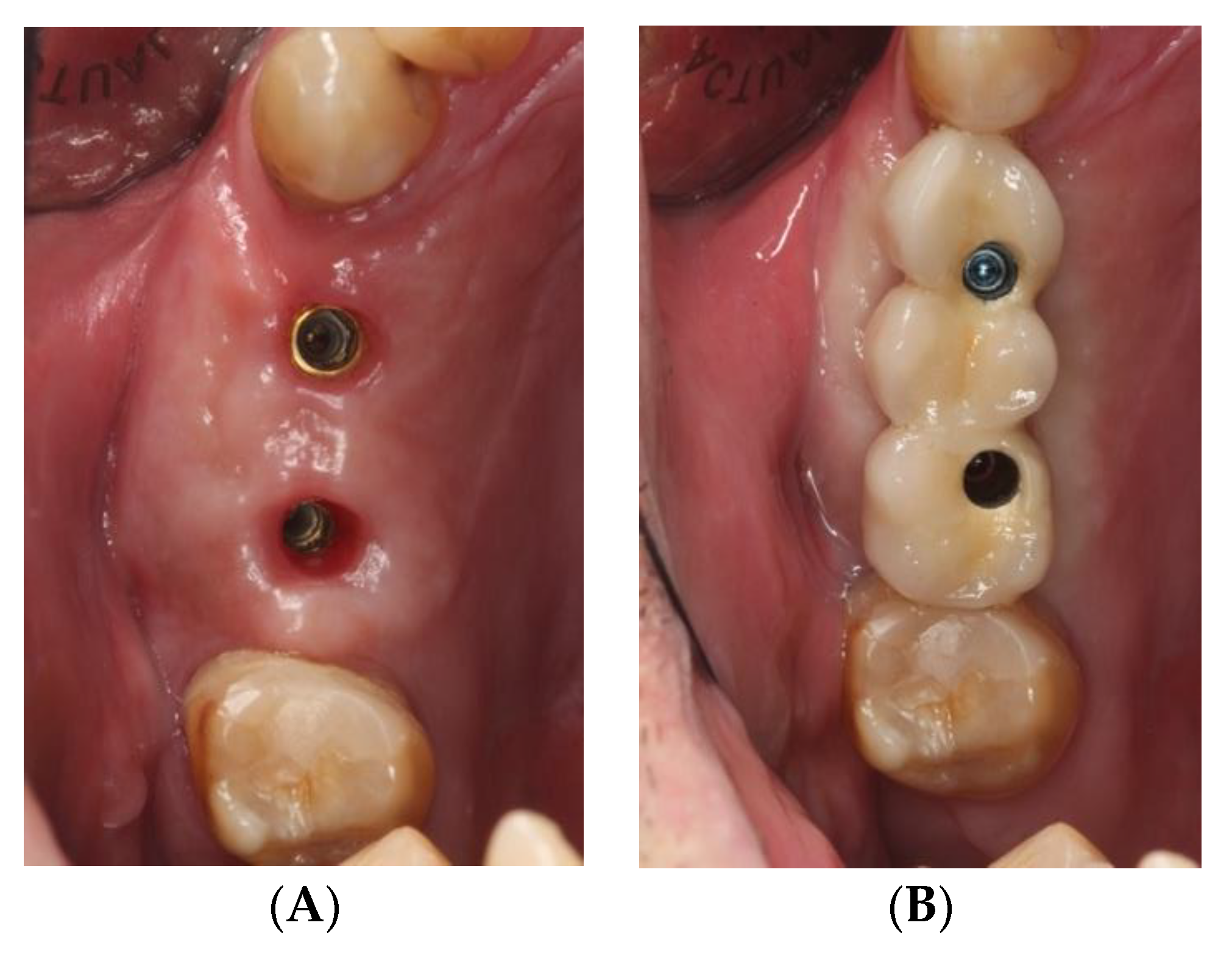 Ijerph 18 05232 g005