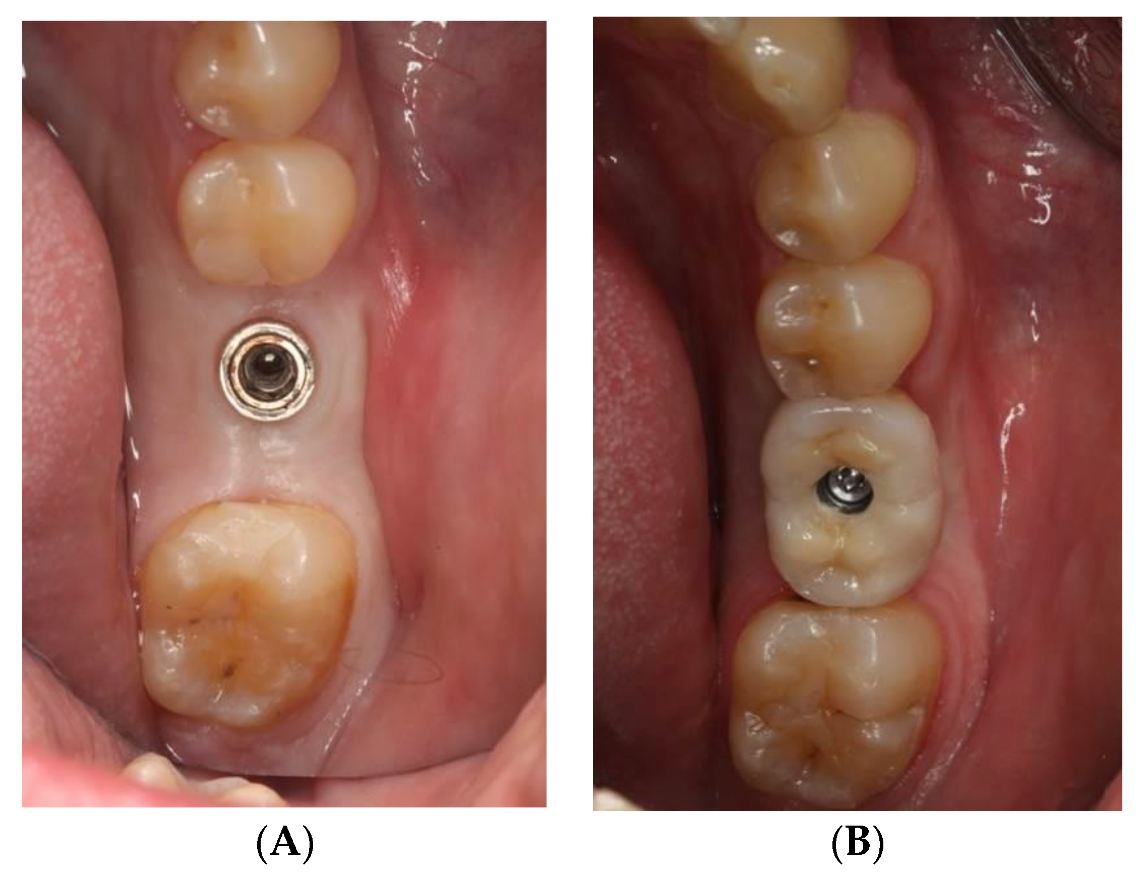 Ijerph 18 05232 g006
