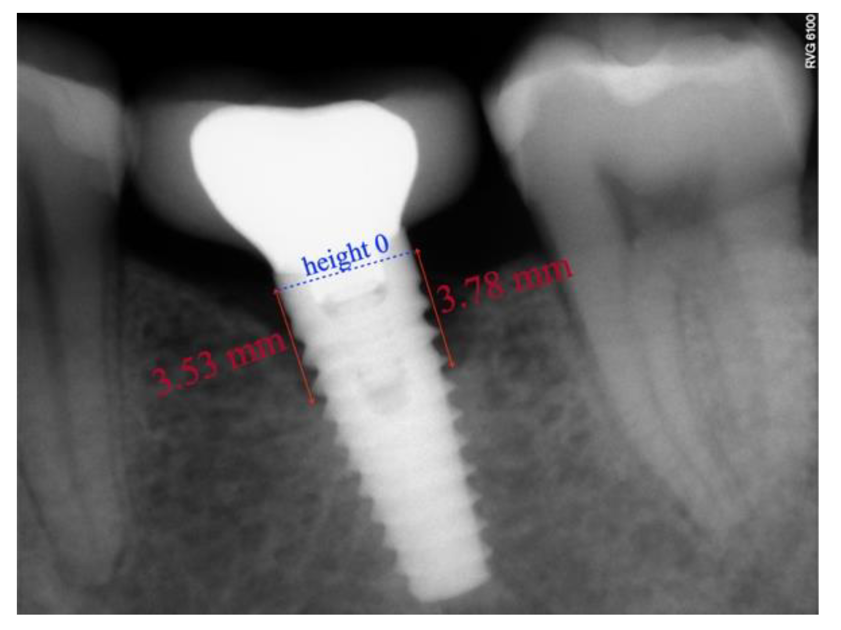 Ijerph 18 05232 g008