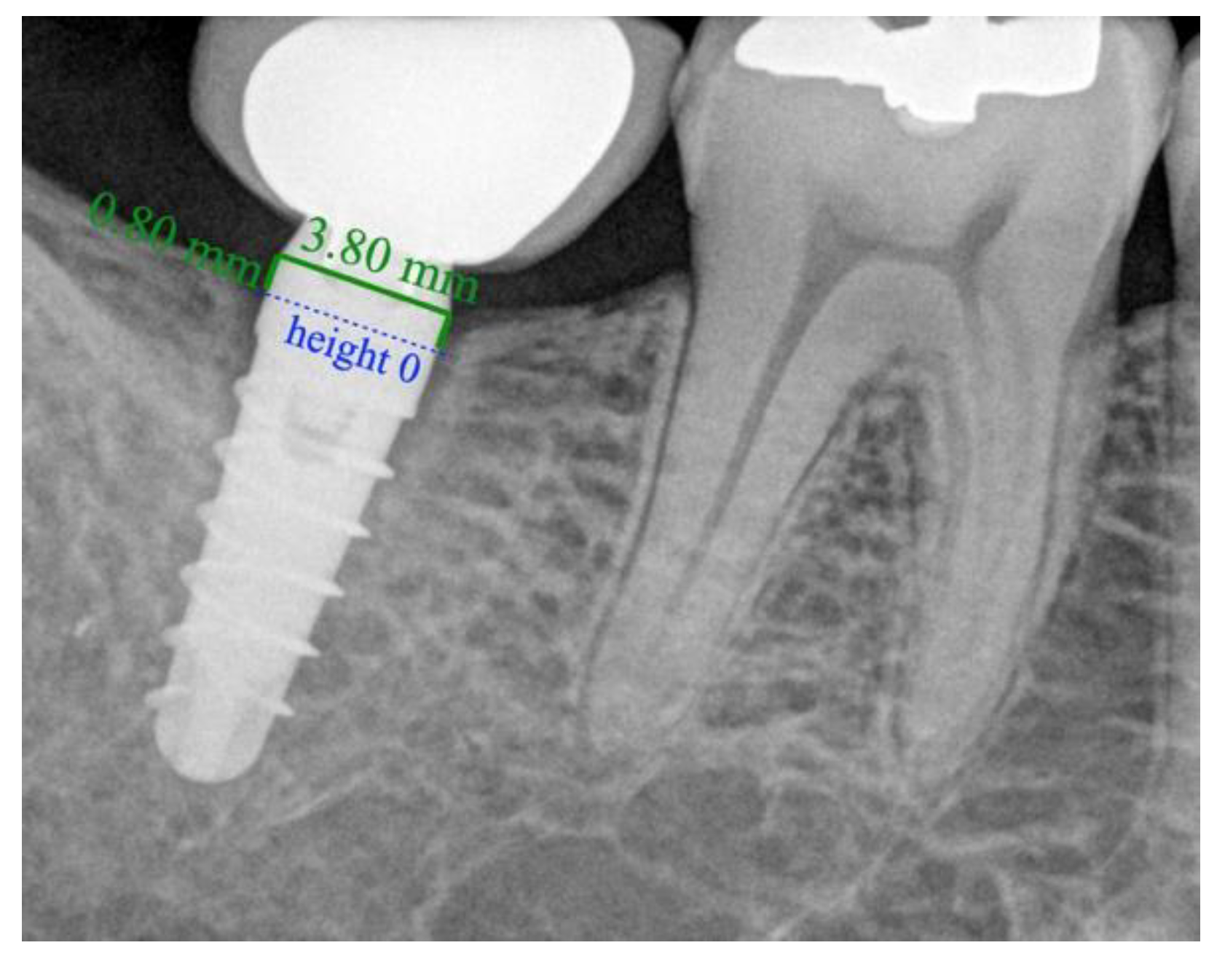 Ijerph 18 05232 g009