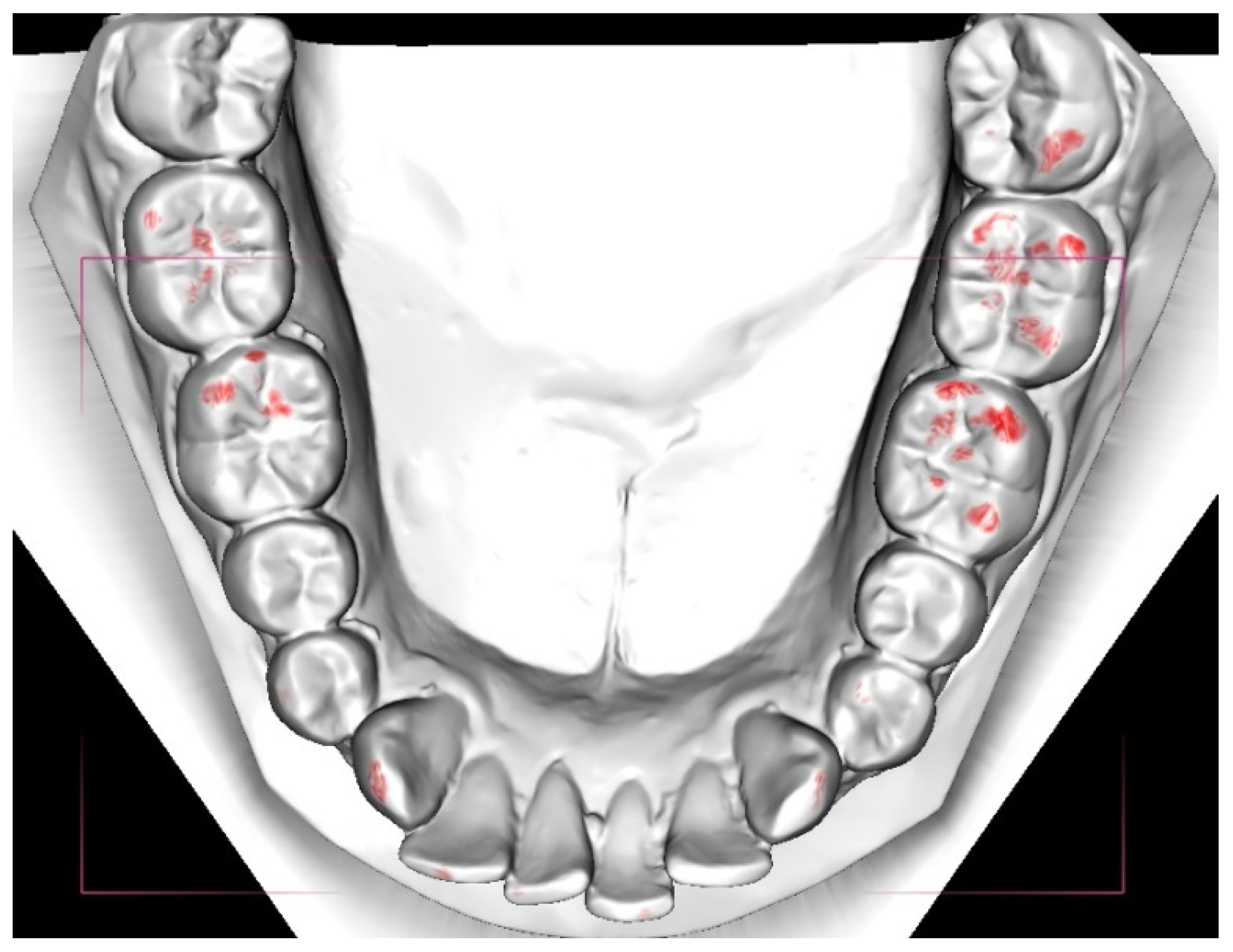 Ijerph 18 05297 g003 Ijerph 18 05297 g003