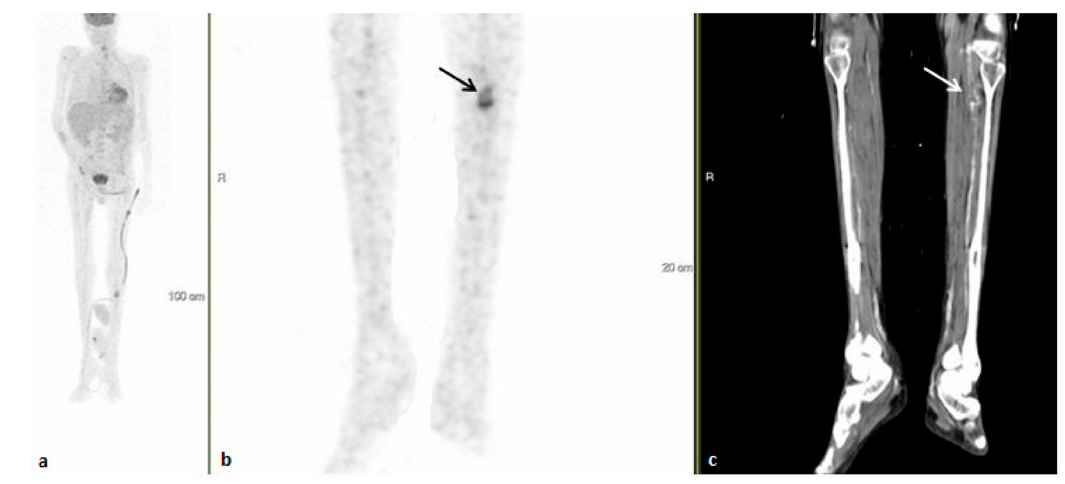 Ijerph 18 05360 g003