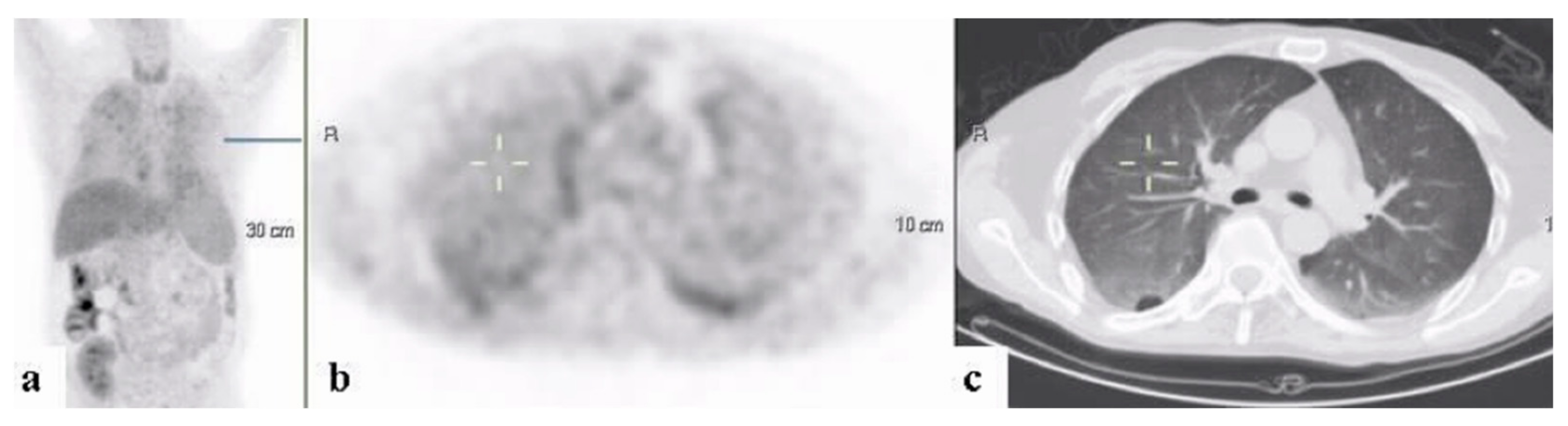 Ijerph 18 05360 g005