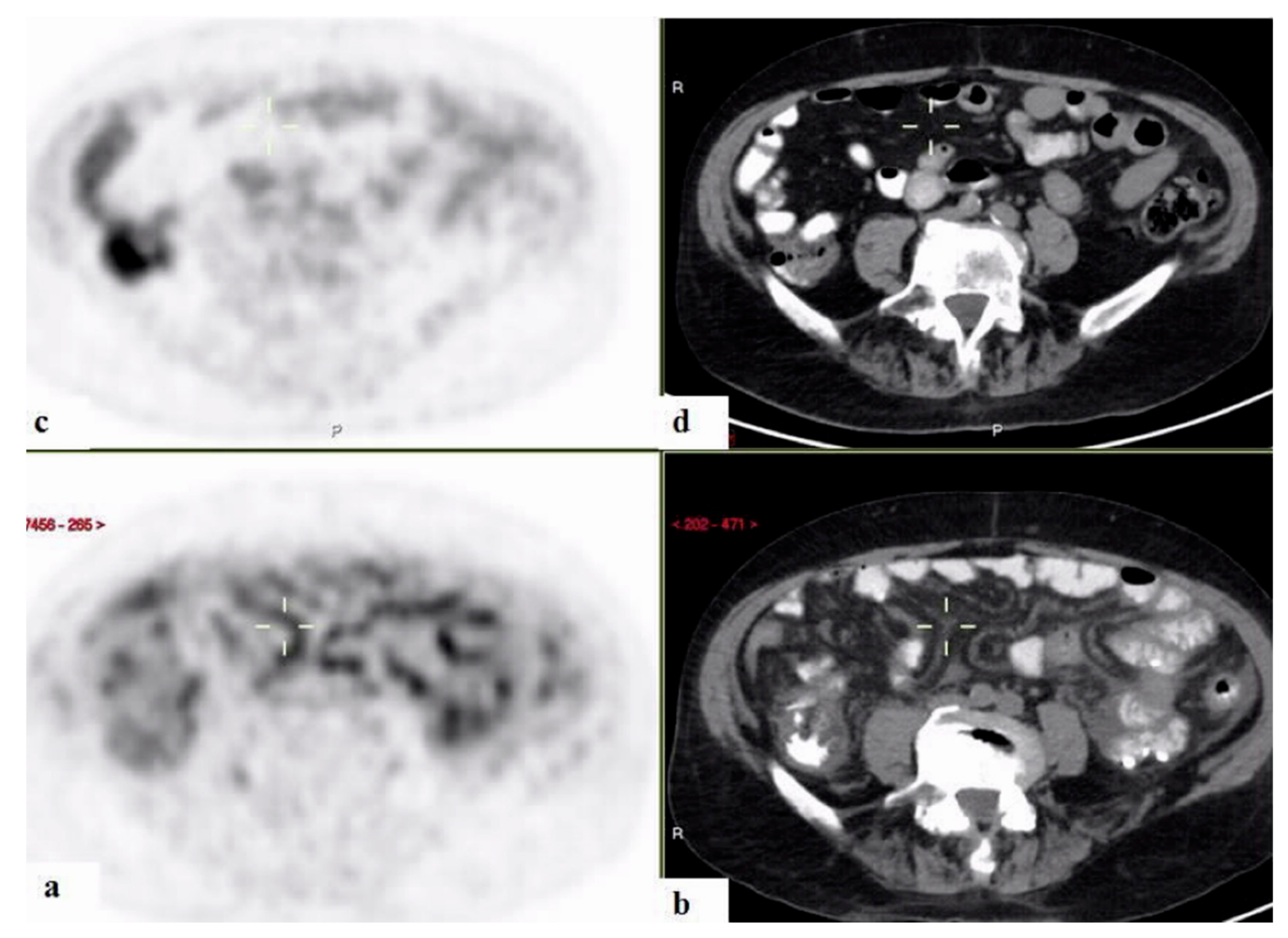 Ijerph 18 05360 g006