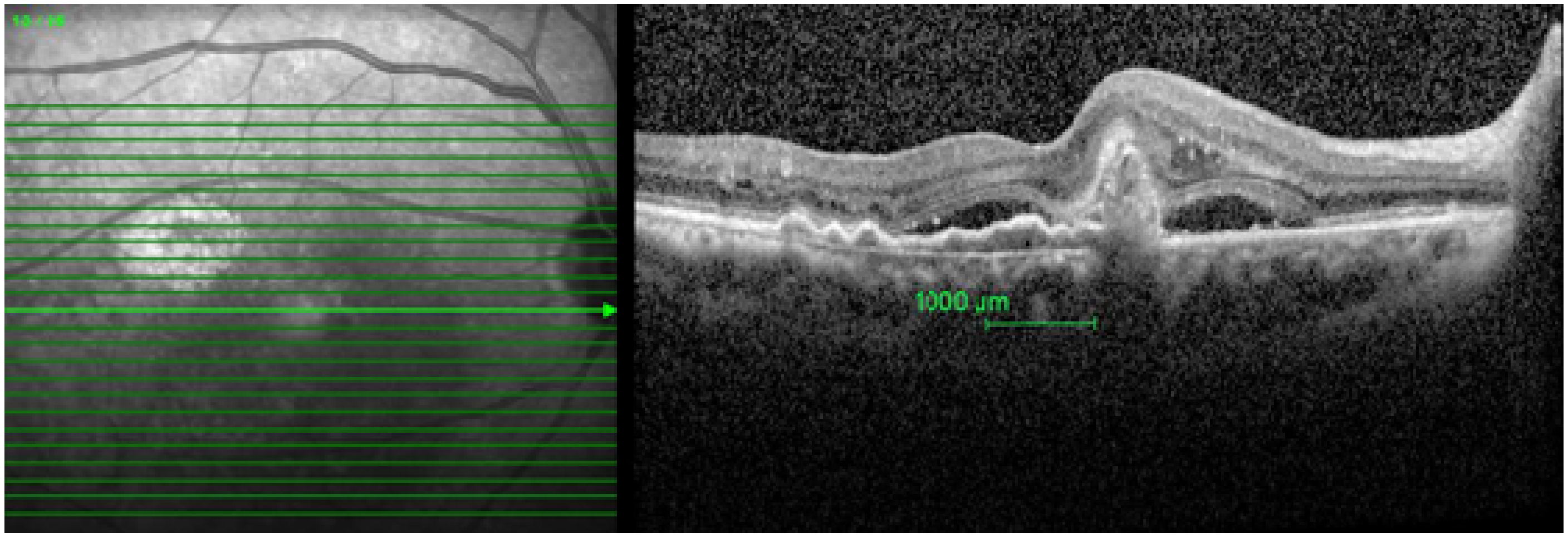 Ijerph 18 05378 g001