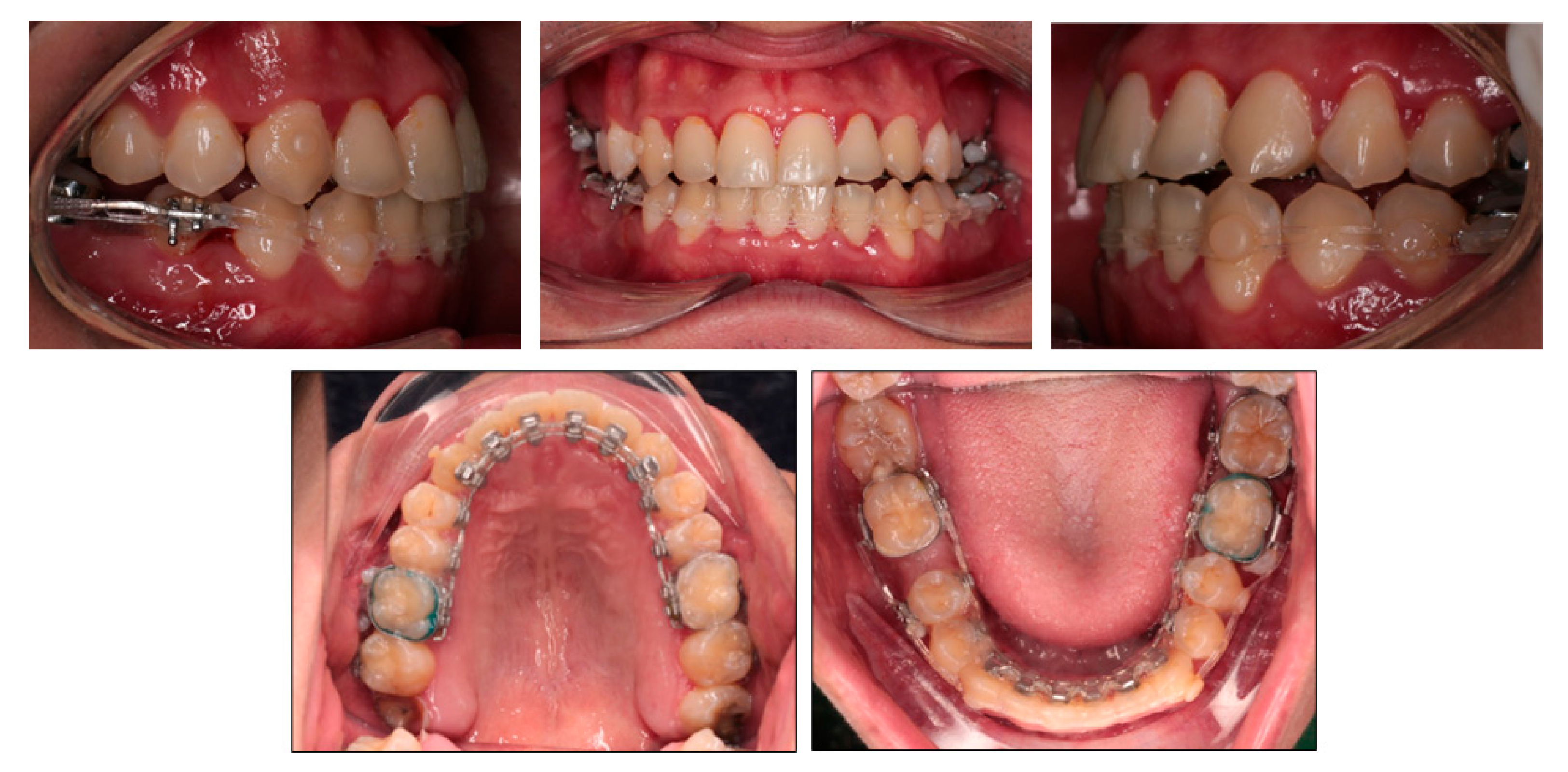 Ijerph 18 05381 g005 Ijerph 18 05381 g005