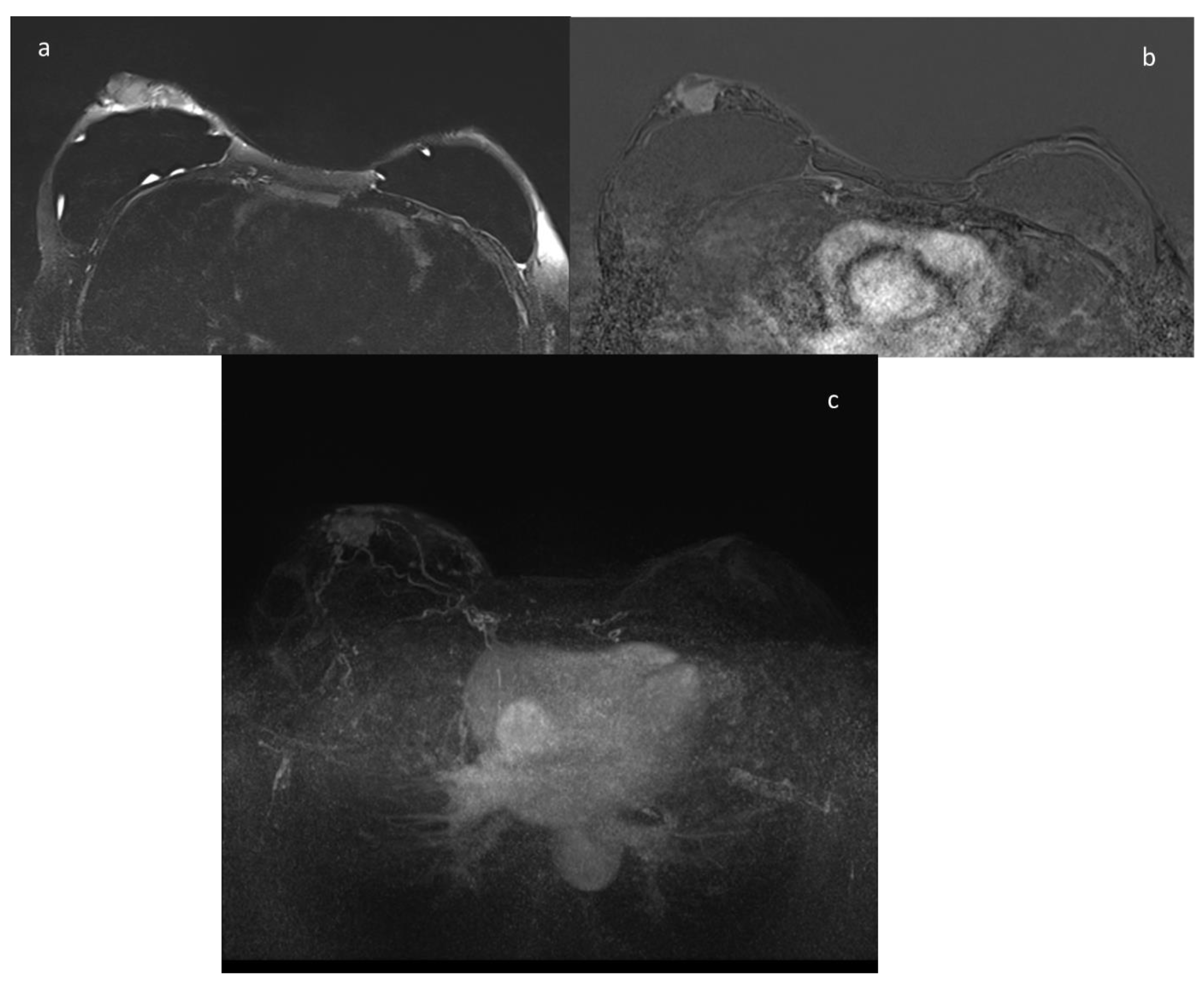 Ijerph 18 05509 g002 Ijerph 18 05509 g002