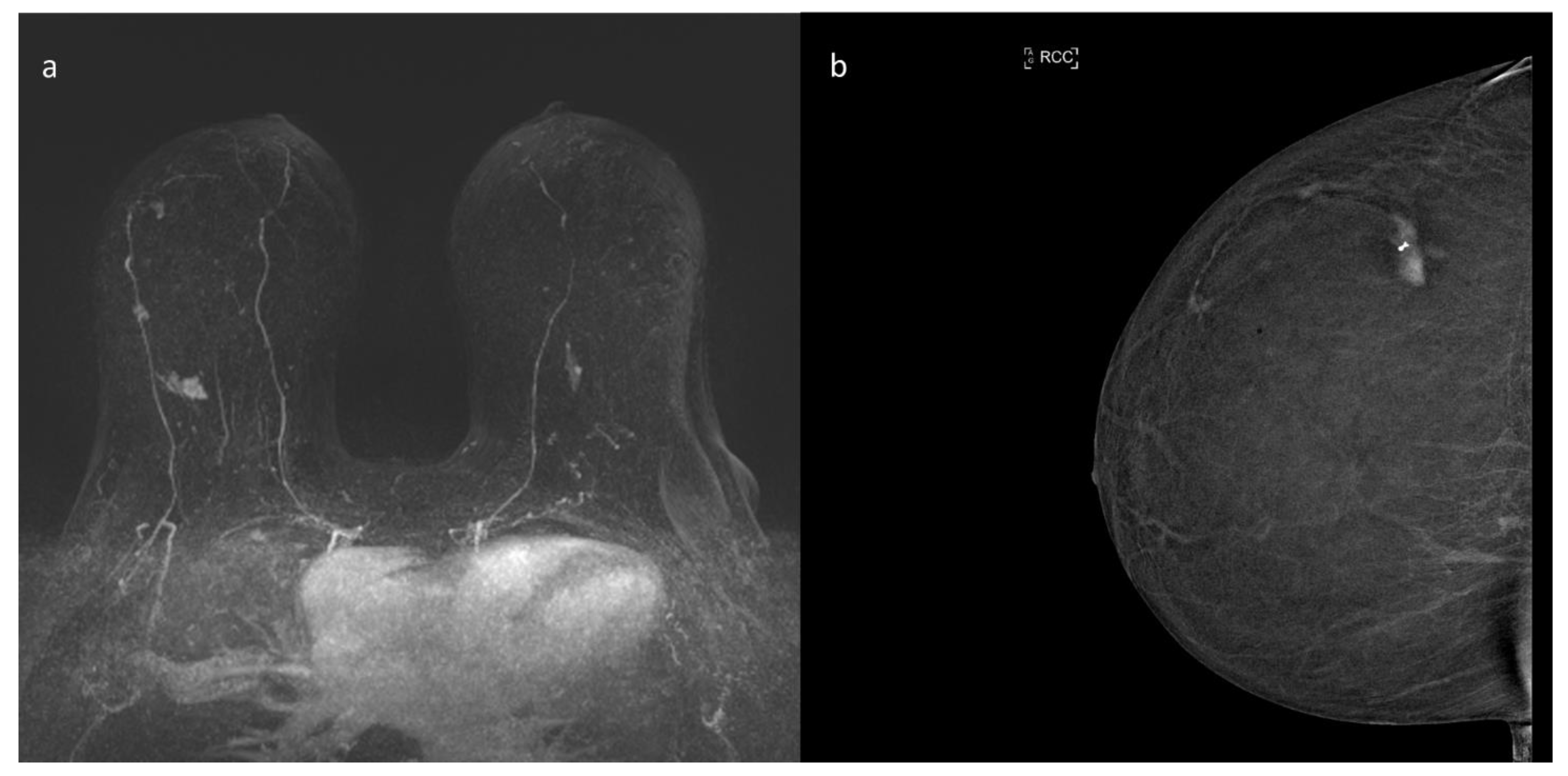 Ijerph 18 05509 g003 Ijerph 18 05509 g003