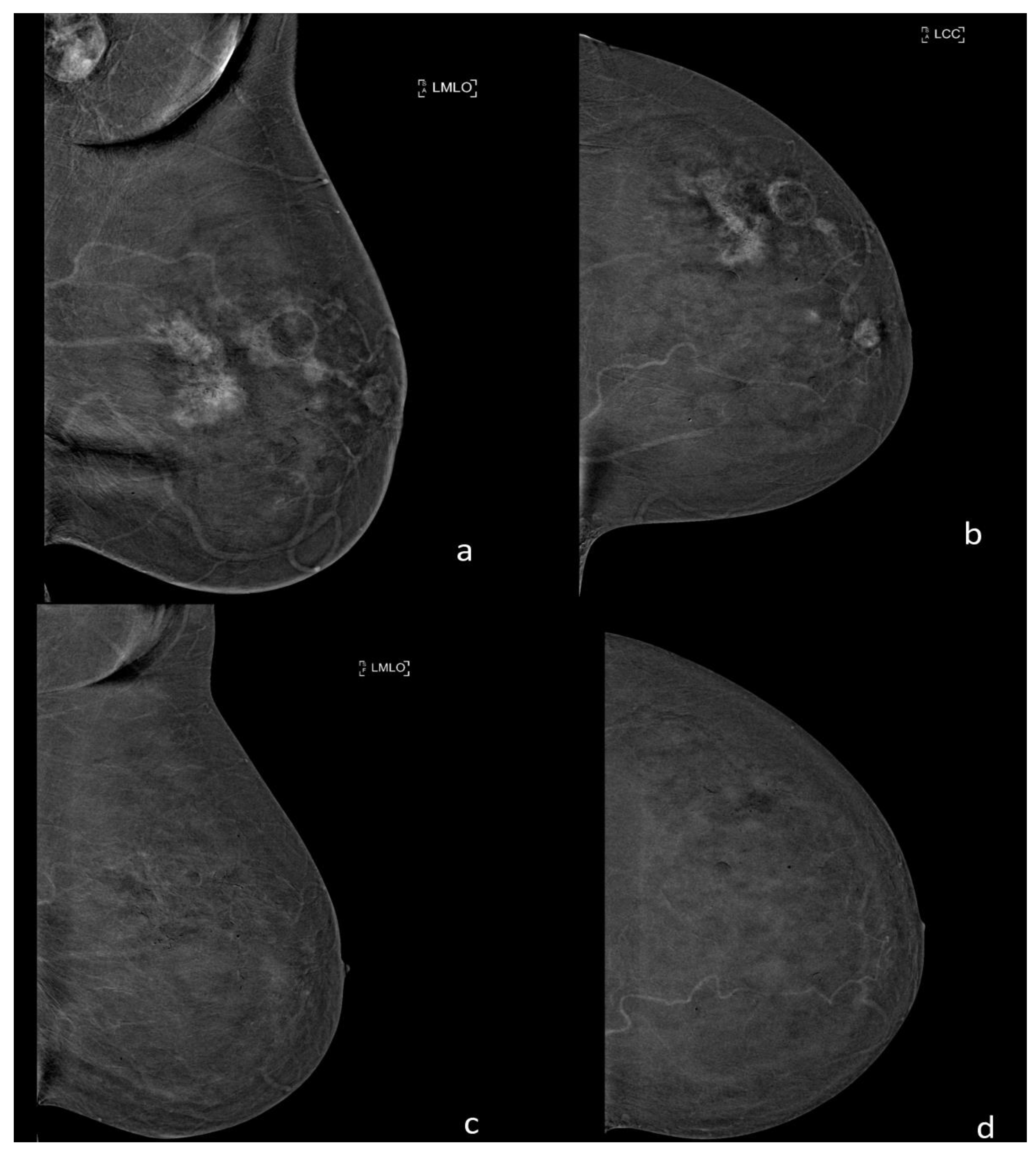 Ijerph 18 05509 g004 Ijerph 18 05509 g004