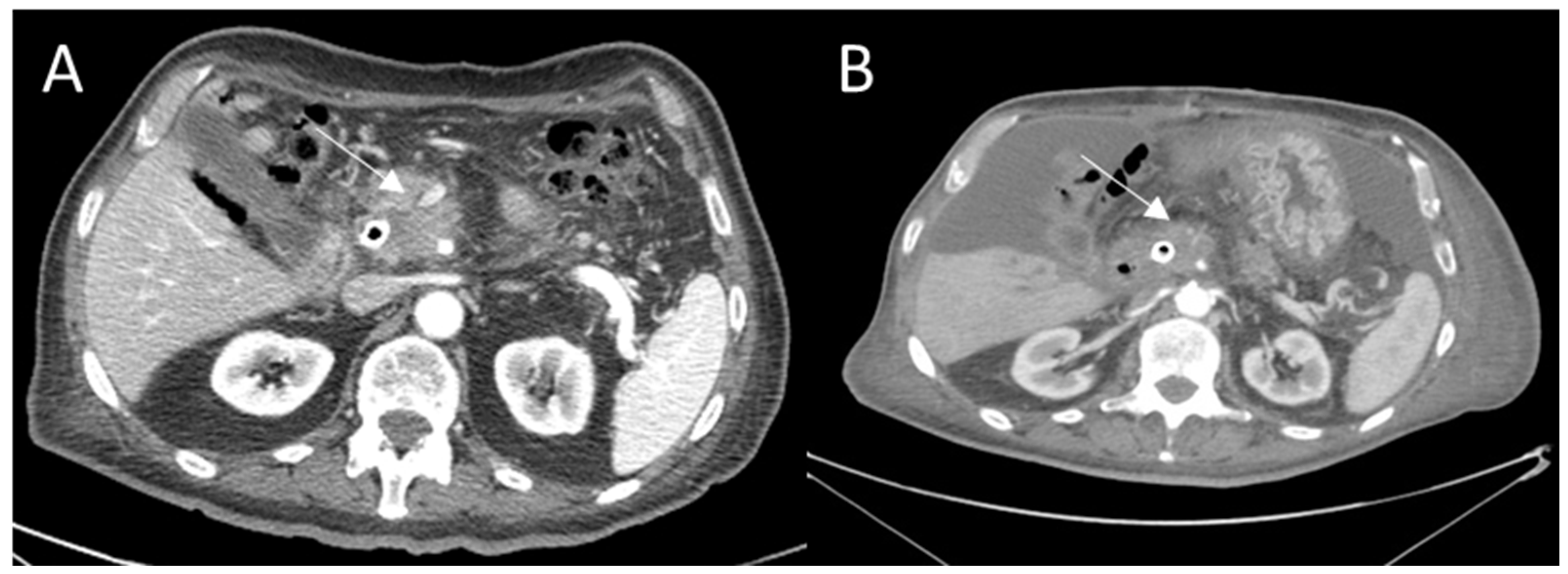 Ijerph 18 05592 g001 Ijerph 18 05592 g001